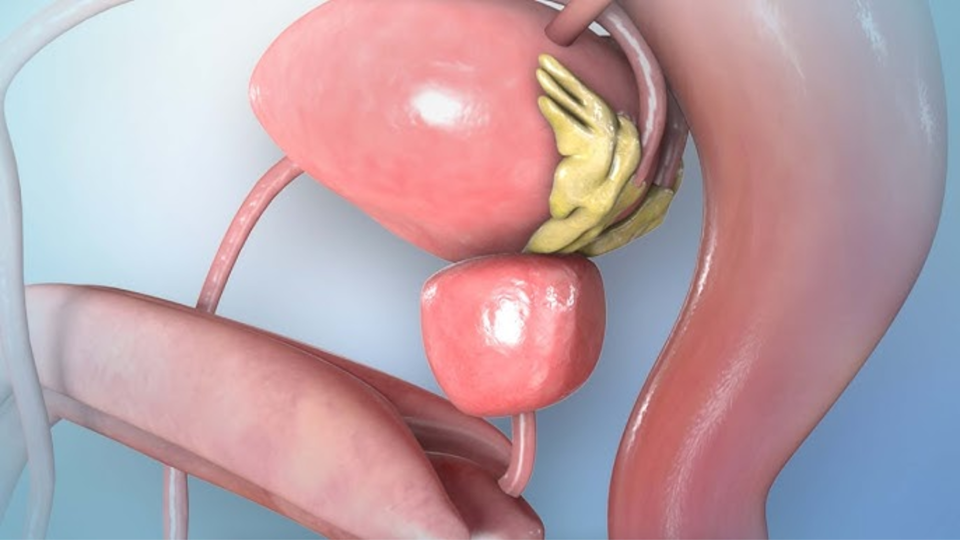 Vôi hóa tuyến tiền liệt là gì? Cách phòng ngừa các biến chứng hiệu quả 1