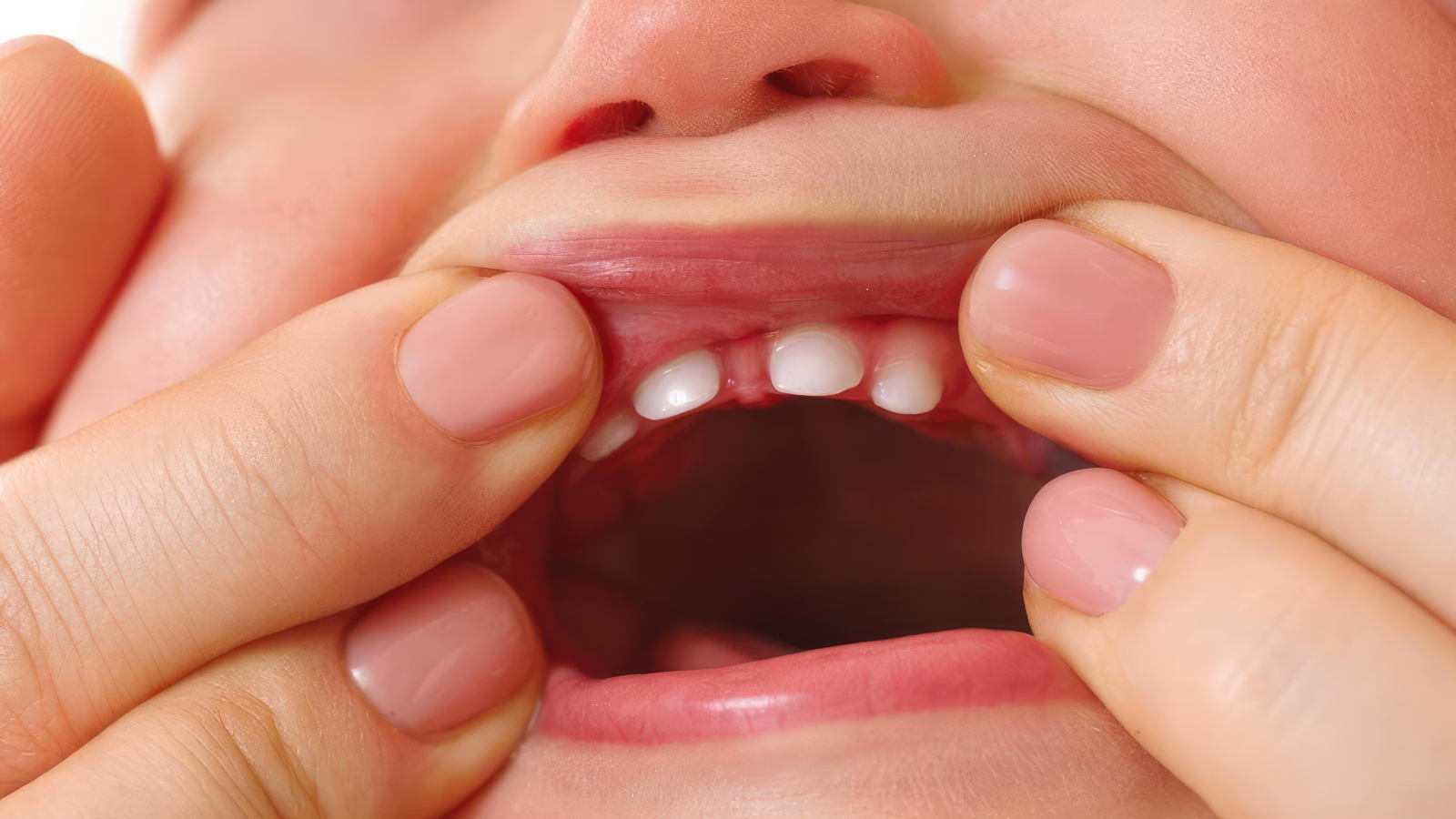 Chảy nước dãi ở trẻ em: Khi nào là bình thường, khi nào cần đi khám? 3