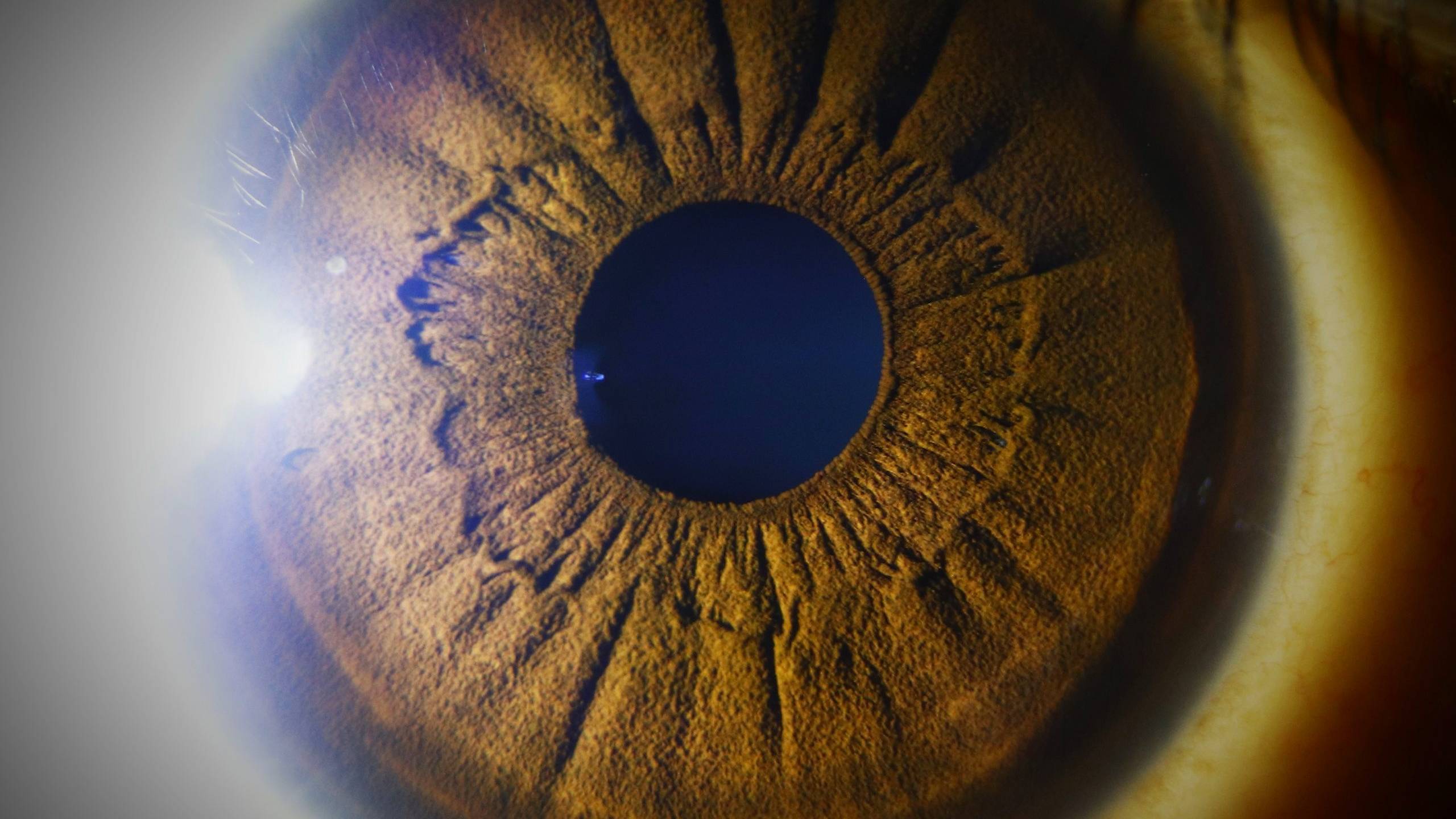 Võng mạc được cấu tạo bởi 10 lớp tế bào xếp chồng lên nhau từ trong ra ngoài