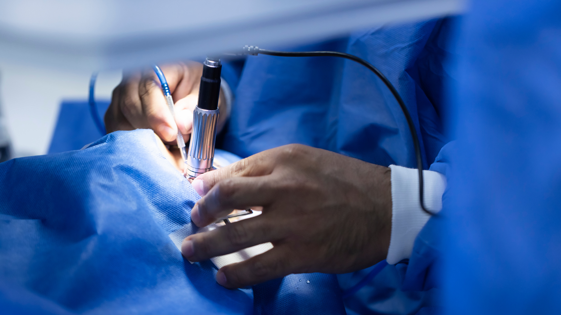 Phẫu thuật giúp cải thiện thị lực rõ rệt và cho kết quả ổn định