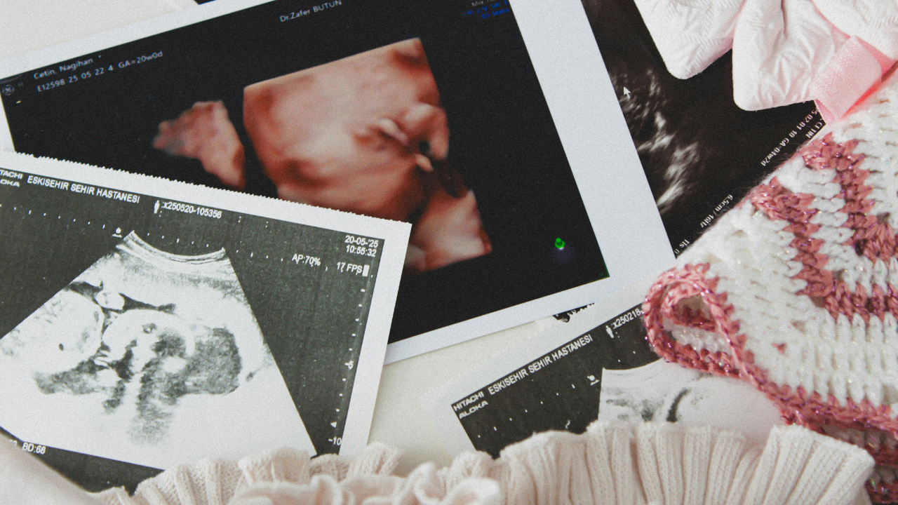 Mẹ nên tiếp tục theo dõi thai kỳ đều đặn