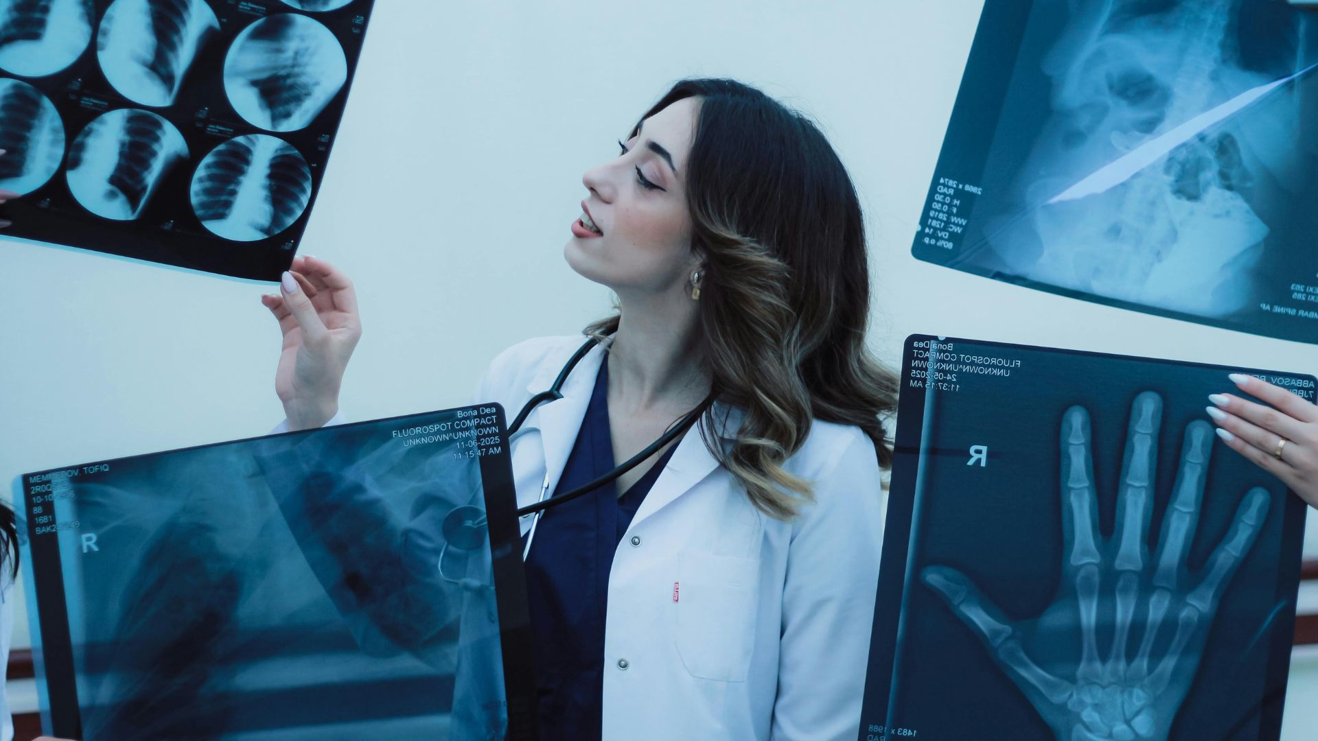 Quy trình chụp X-quang bàn tay