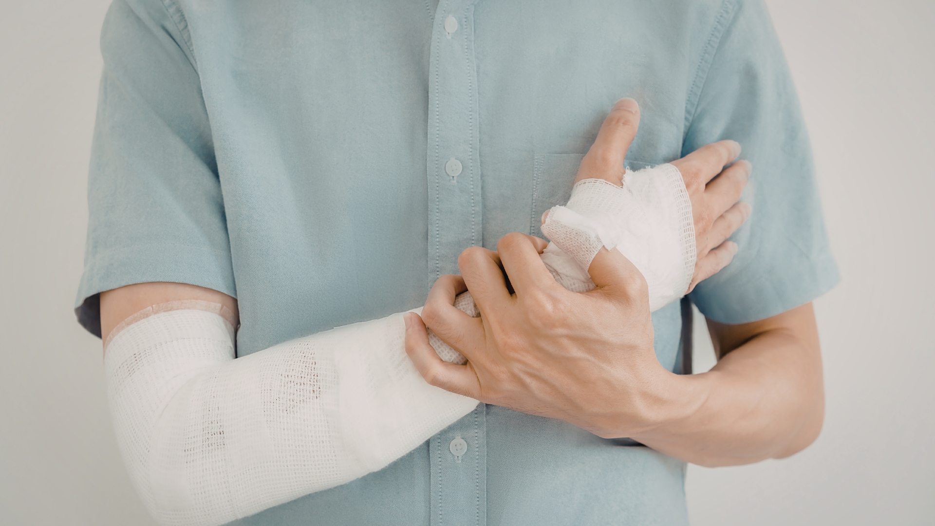 Khi kết quả X-quang cho thấy gãy xương không di lệch, bác sĩ thường chỉ định bó bột