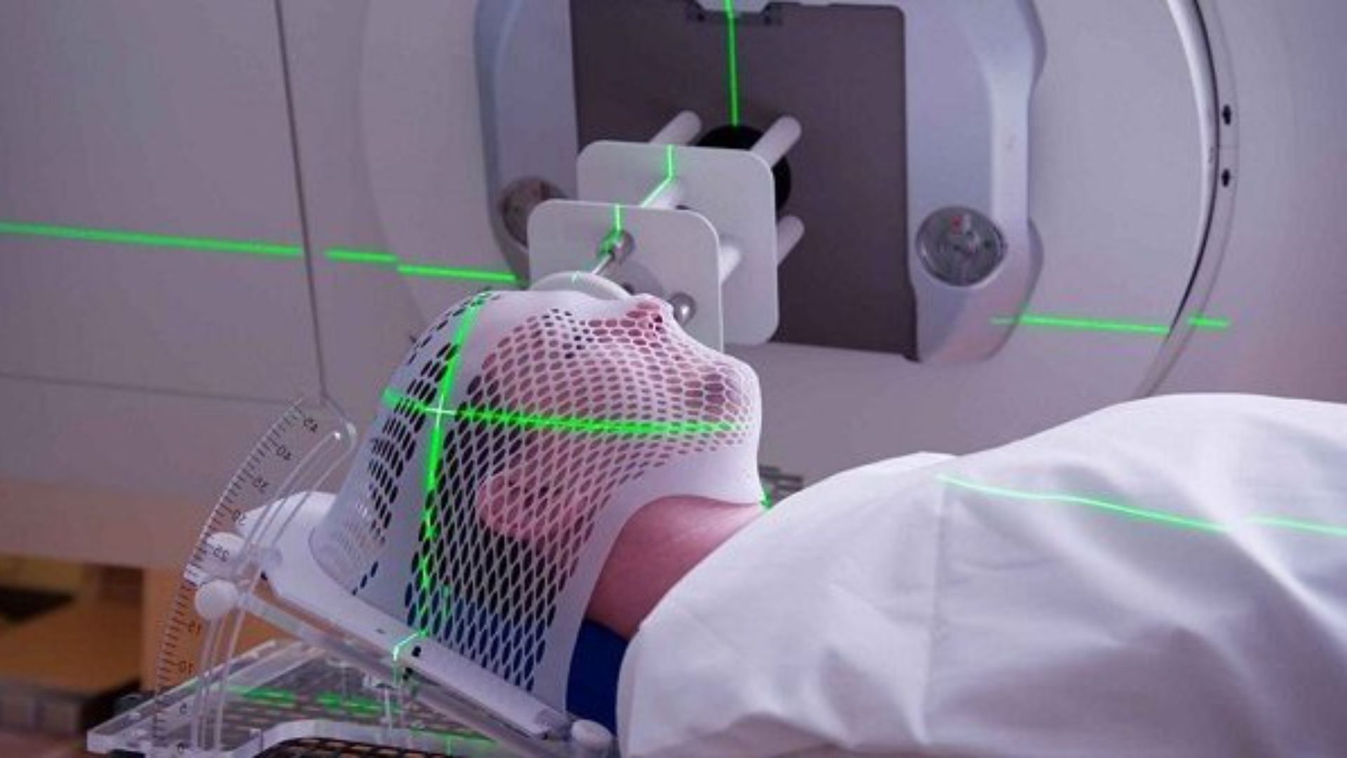 Xạ trị là gì? Những thông tin cơ bản nhất về phương pháp xạ trị ung thư 4
