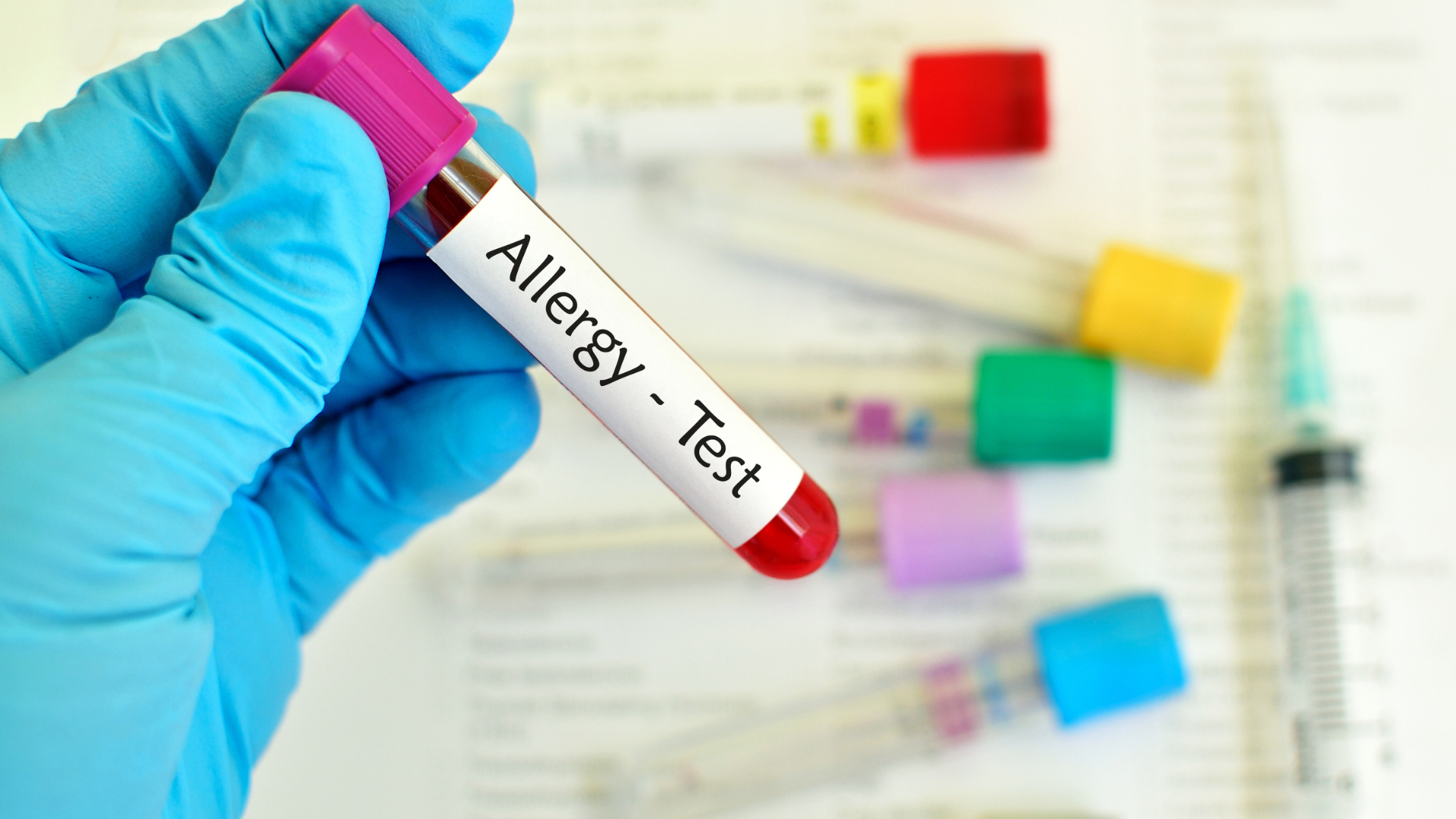 Xét nghiệm 60 dị nguyên là xét nghiệm máu nhằm kiểm tra phản ứng của hệ miễn dịch đối với 60 tác nhân dị ứng thường gặp trong cuộc sống