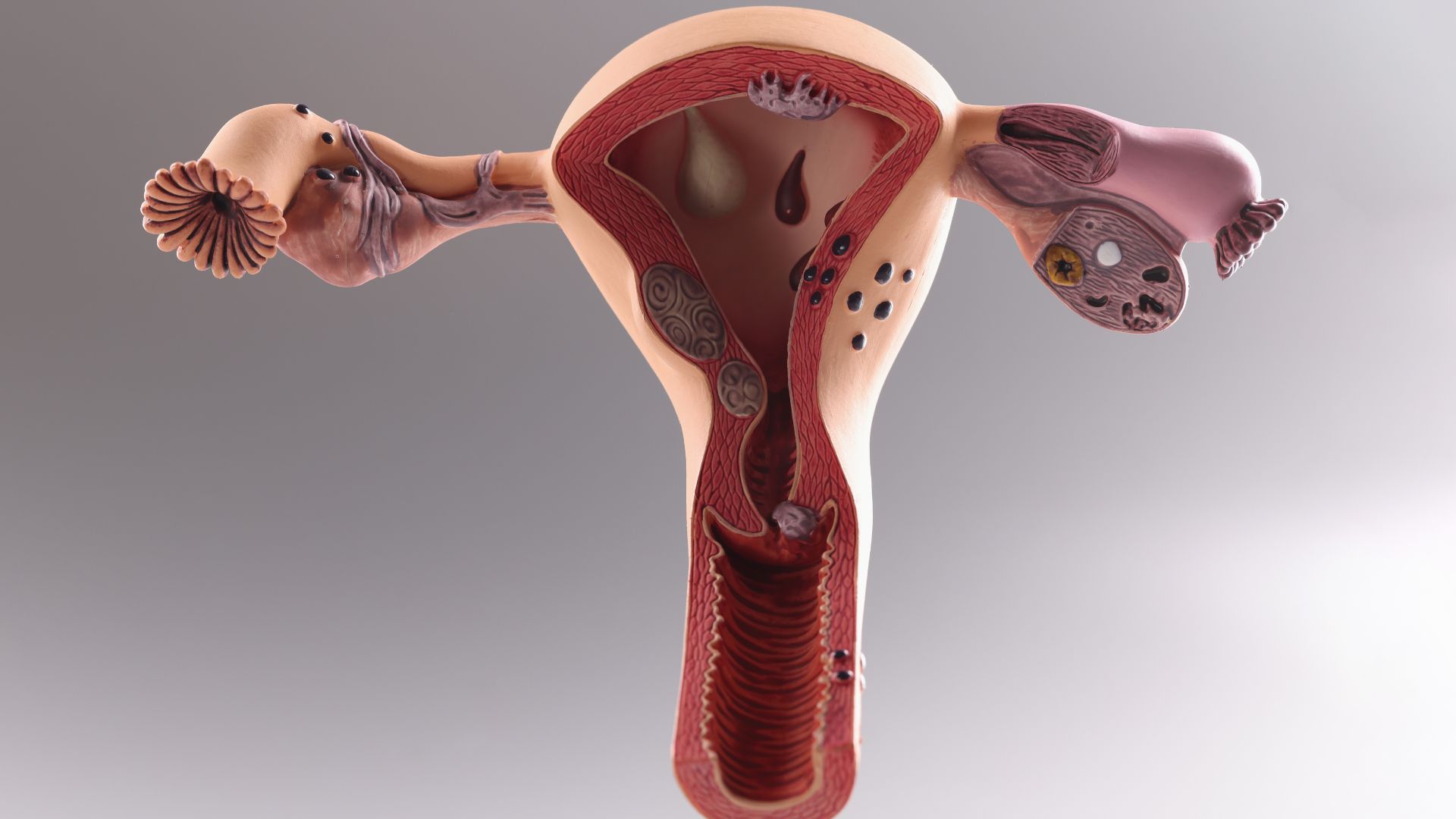 Xét nghiệm Thinprep khác gì xét nghiệm PAP? Khi nào cần thực hiện xét nghiệm ThinPrep? 1