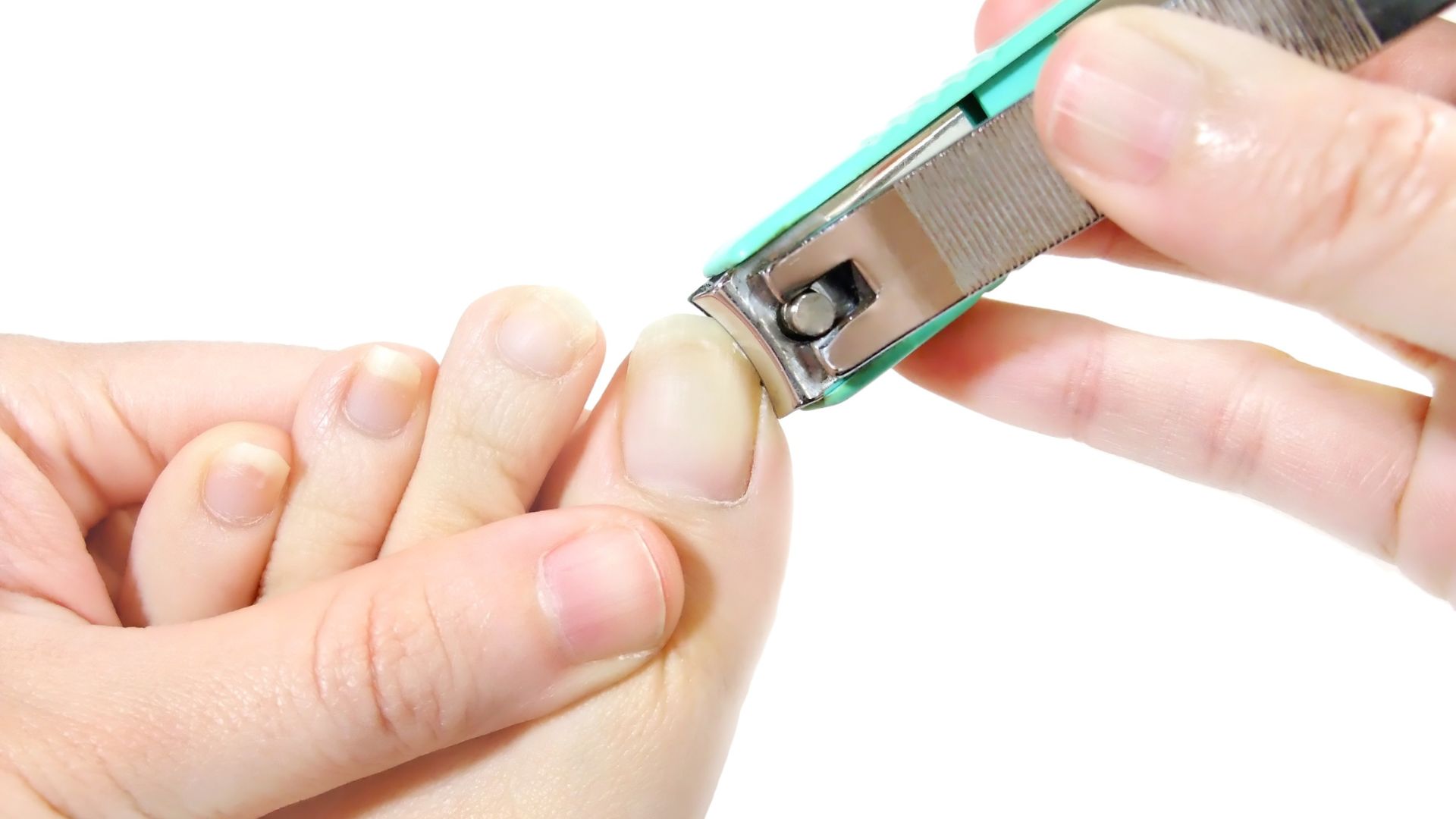 Mẫu móng tay, móng chân có thế được sử dụng làm mẫu xét nghiệm ADN