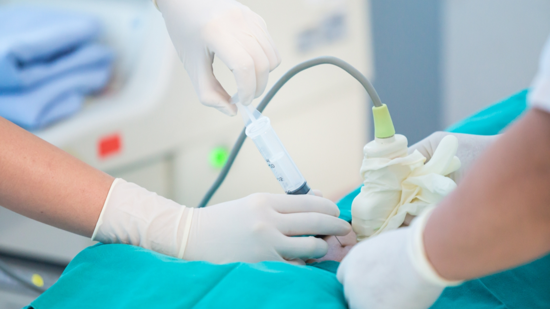 Chọc ối là một phương pháp xét nghiệm ADN cha con trước sinh