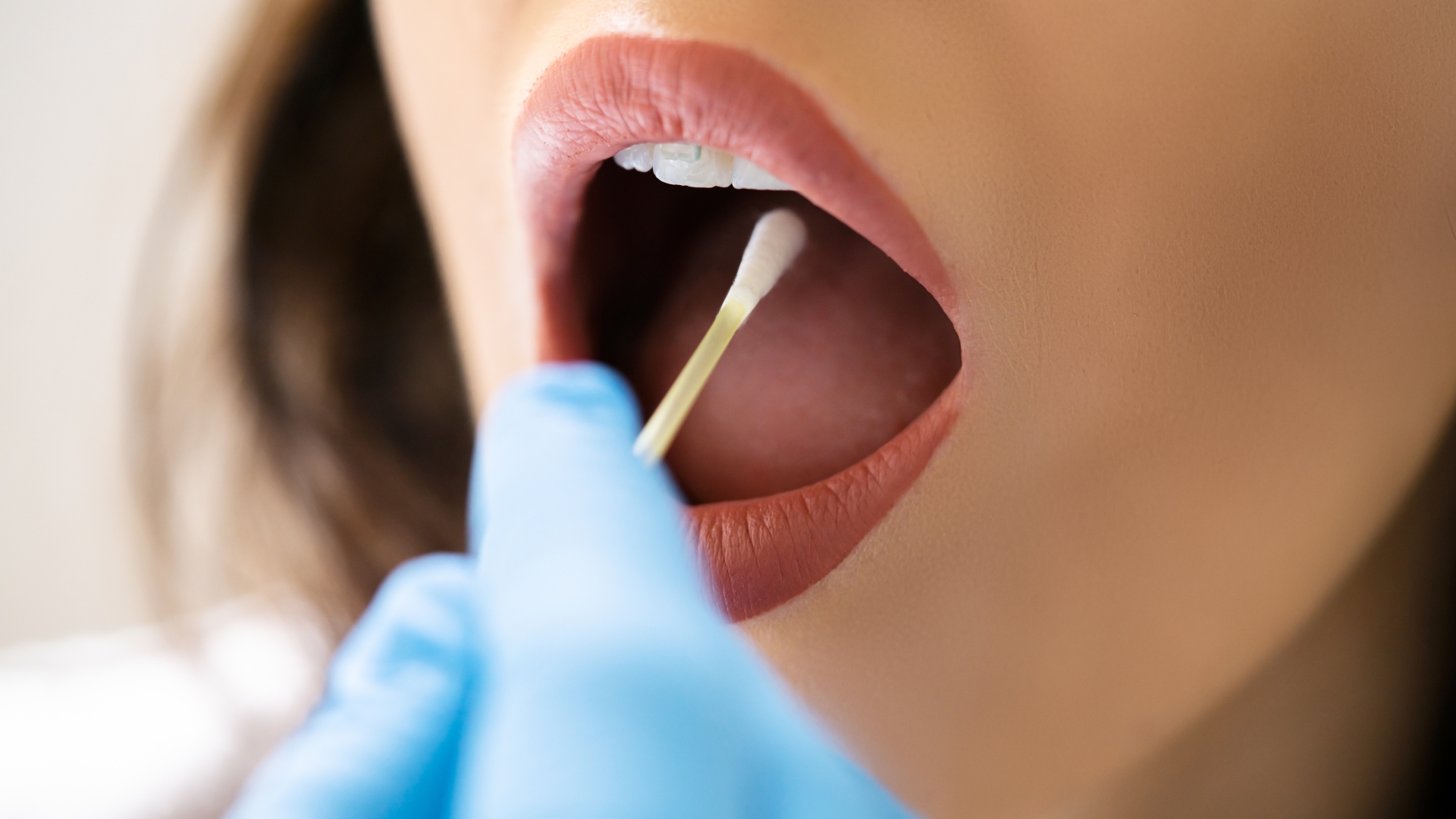 Không nên ăn uống trước khi lấy mẫu niêm mạc miệng trong một khoảng thời gian nhất định để tránh ảnh hưởng chất lượng mẫu