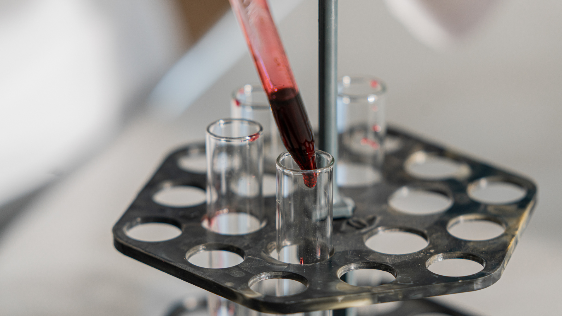 Thời gian thực hiện xét nghiệm có thể ảnh hưởng tới kết quả