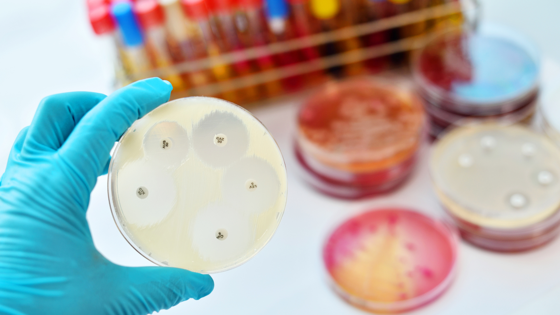 Quy trình xét nghiệm bạch hầu cơ bản