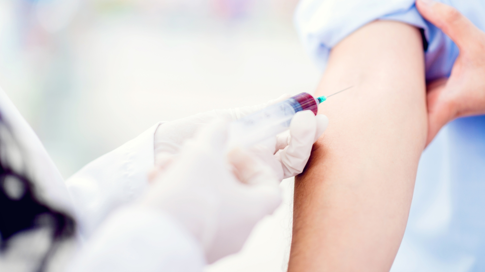 Xét nghiệm CA 15-3 được thực hiện bằng cách lấy máu tĩnh mạch, thường ở vùng cánh tay