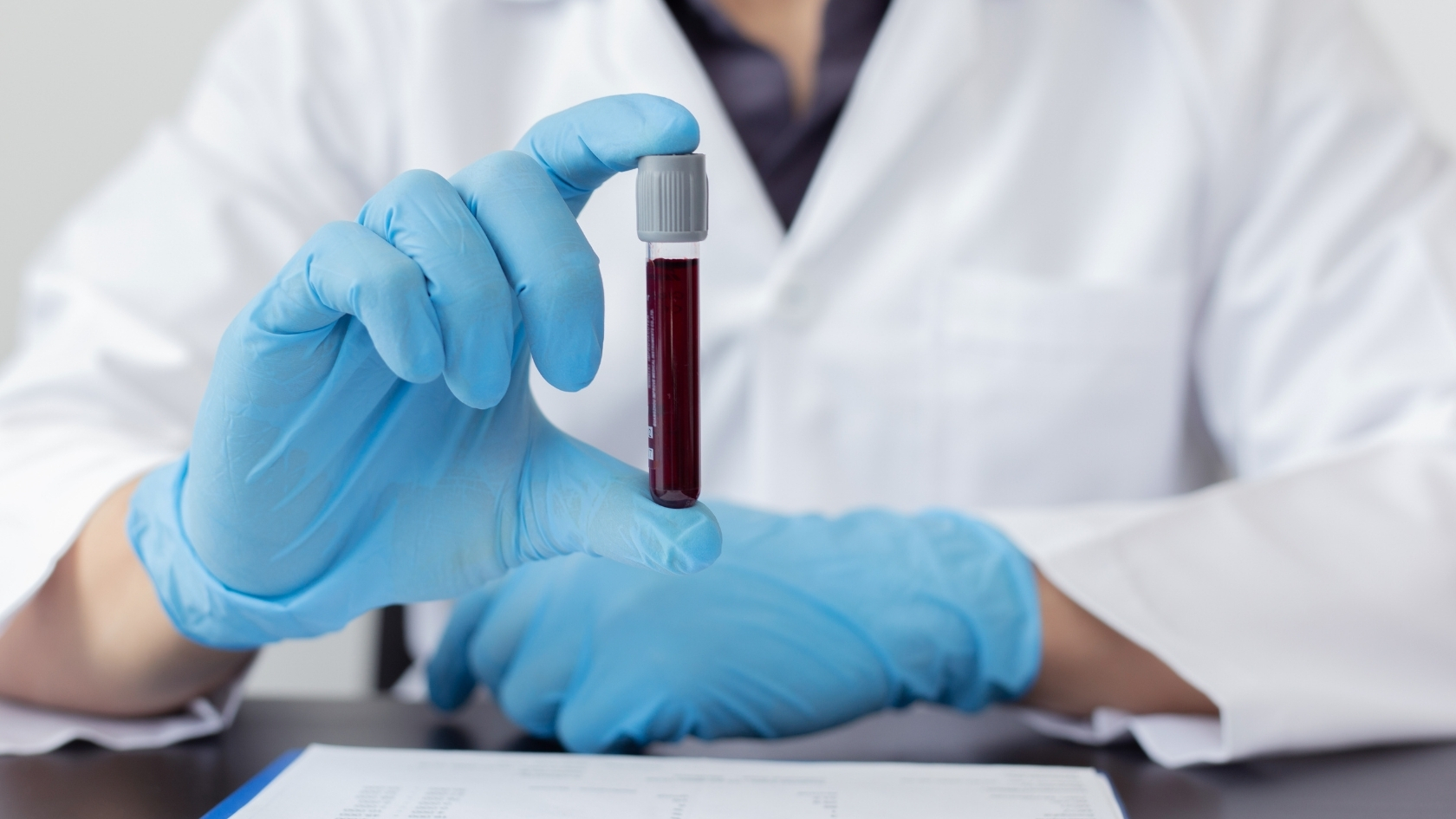 Xét nghiệm CA 15-3 không có giá trị trong chẩn đoán sớm hay sàng lọc ung thư vú ở người khỏe mạnh, do độ nhạy và độ đặc hiệu thấp