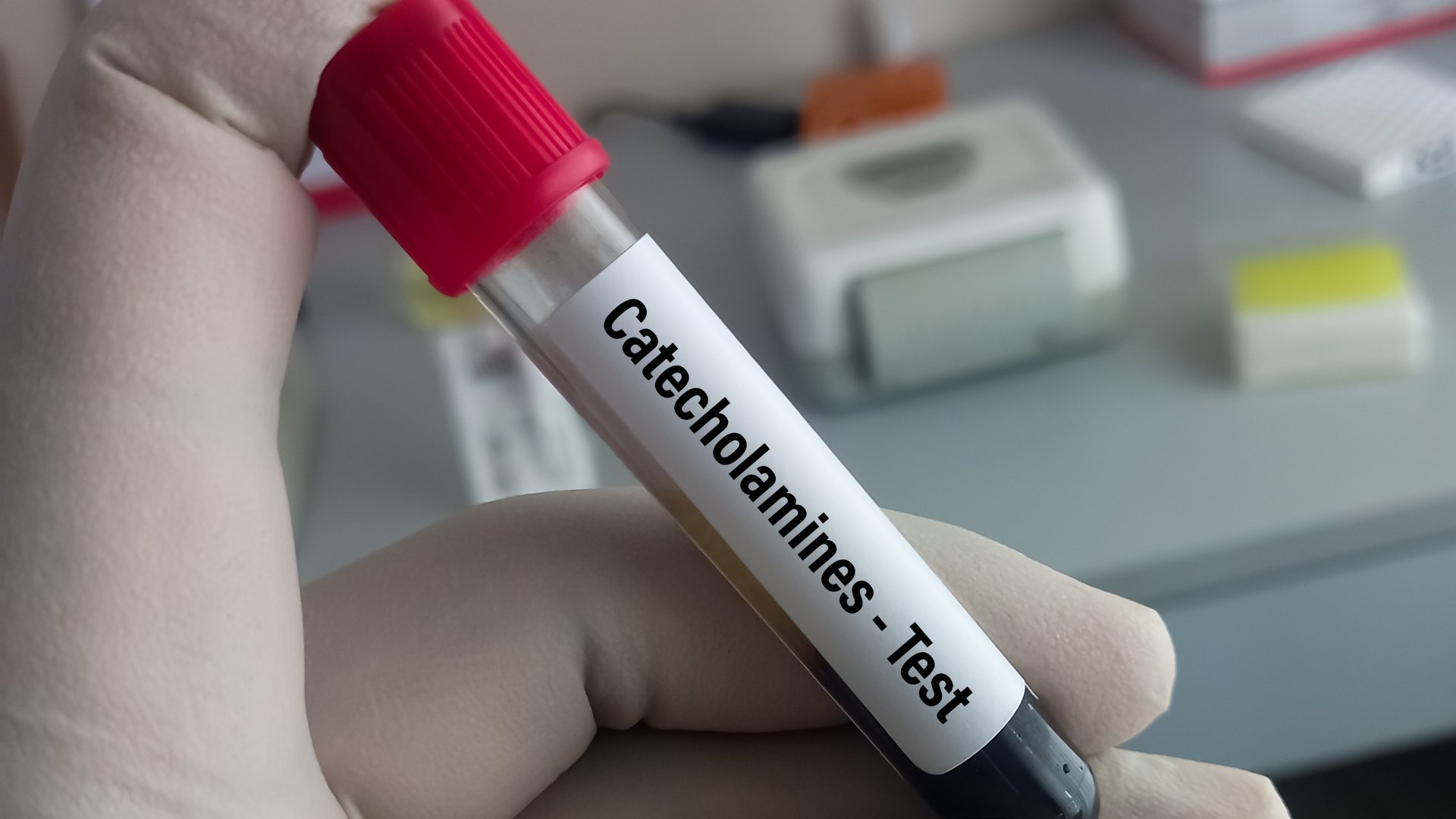 Xét nghiệm Catecholamine cho biết nồng độ các hormone như epinephrine, norepinephrine, dopamine