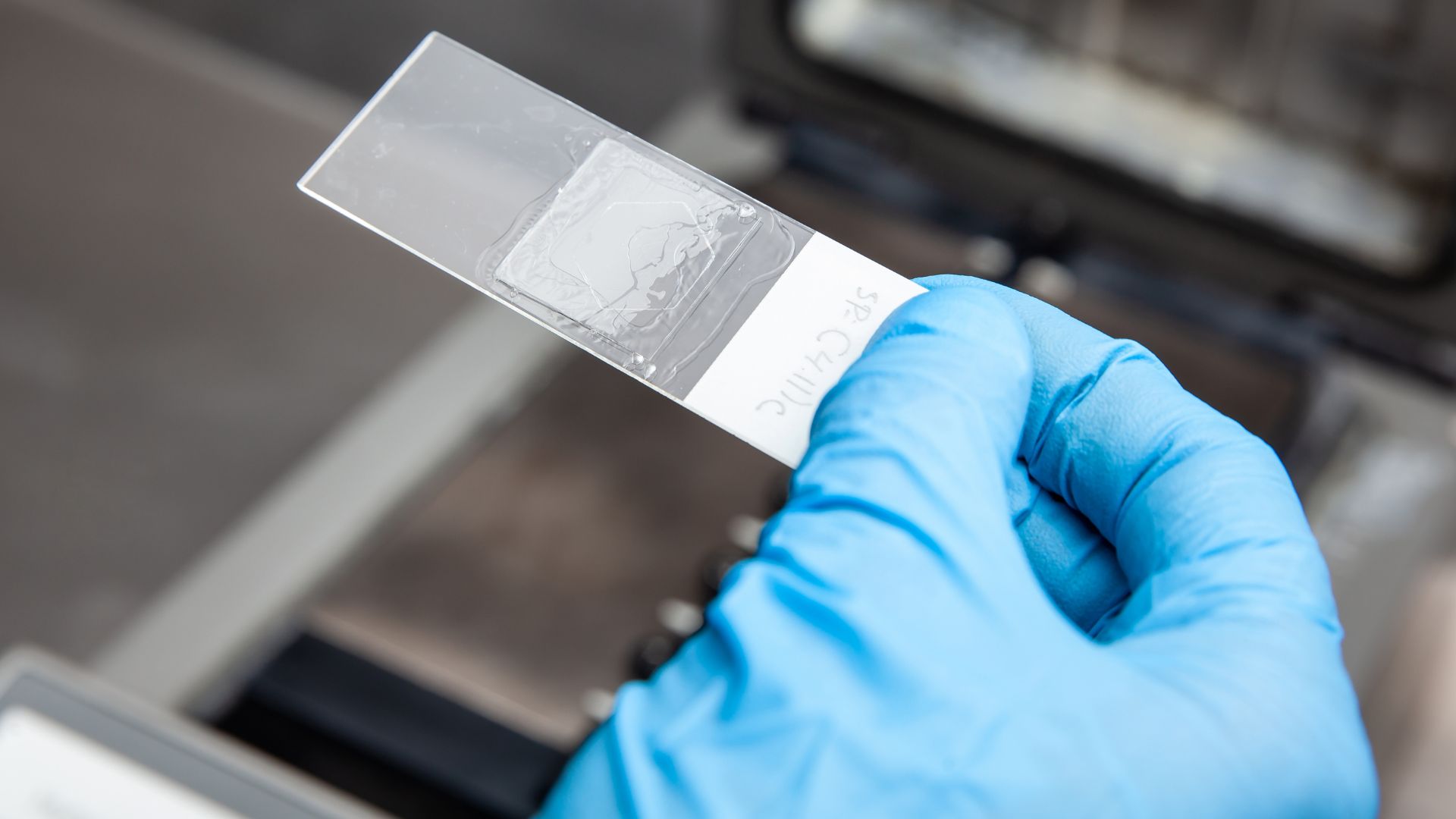 Loại xét nghiệm thực hiện ảnh hưởng trực tiếp đến chi phí chọc ối