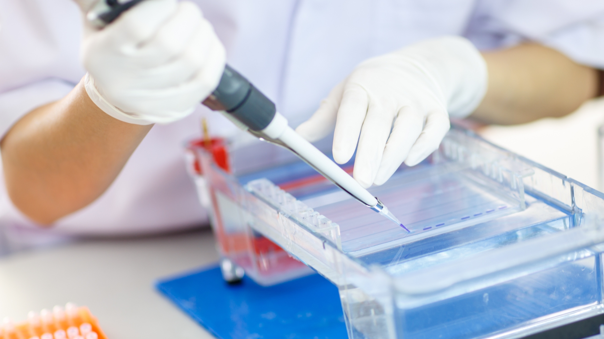 Sau khi lấy máu và ly tâm, huyết thanh sẽ được đưa vào hệ thống điện di