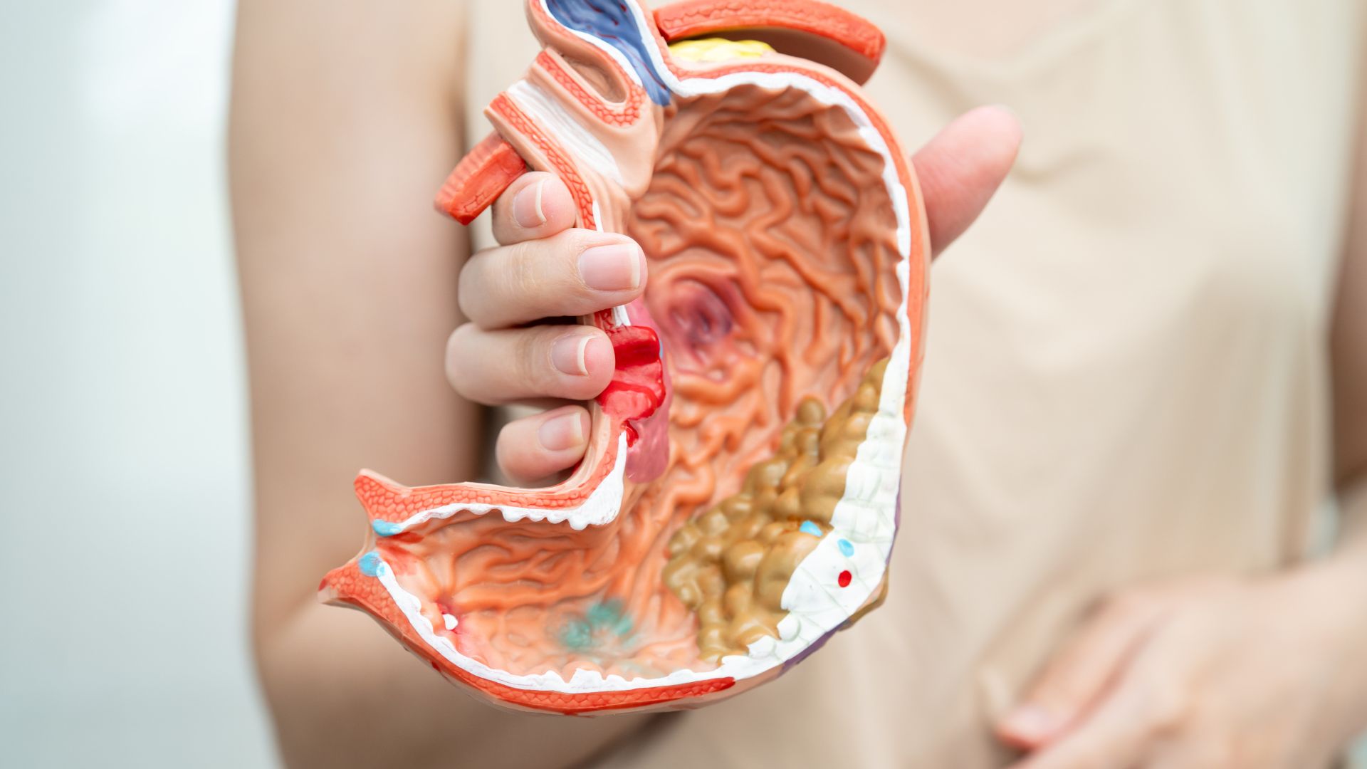 Nồng độ CA 19-9 giúp hỗ trợ, đánh giá các vấn đề trong ung thư đường tiêu hóa khác