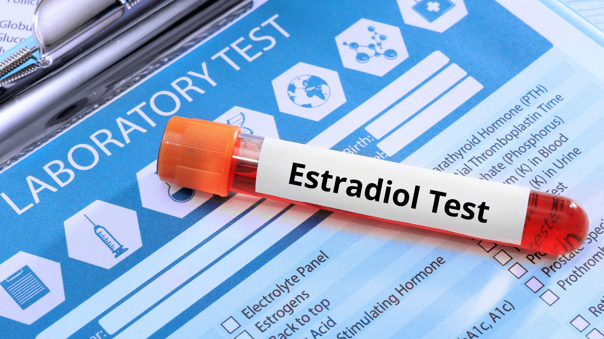 Xét nghiệm định lượng Estradiol là xét nghiệm máu dùng để đo nồng độ hormone Estradiol trong huyết thanh