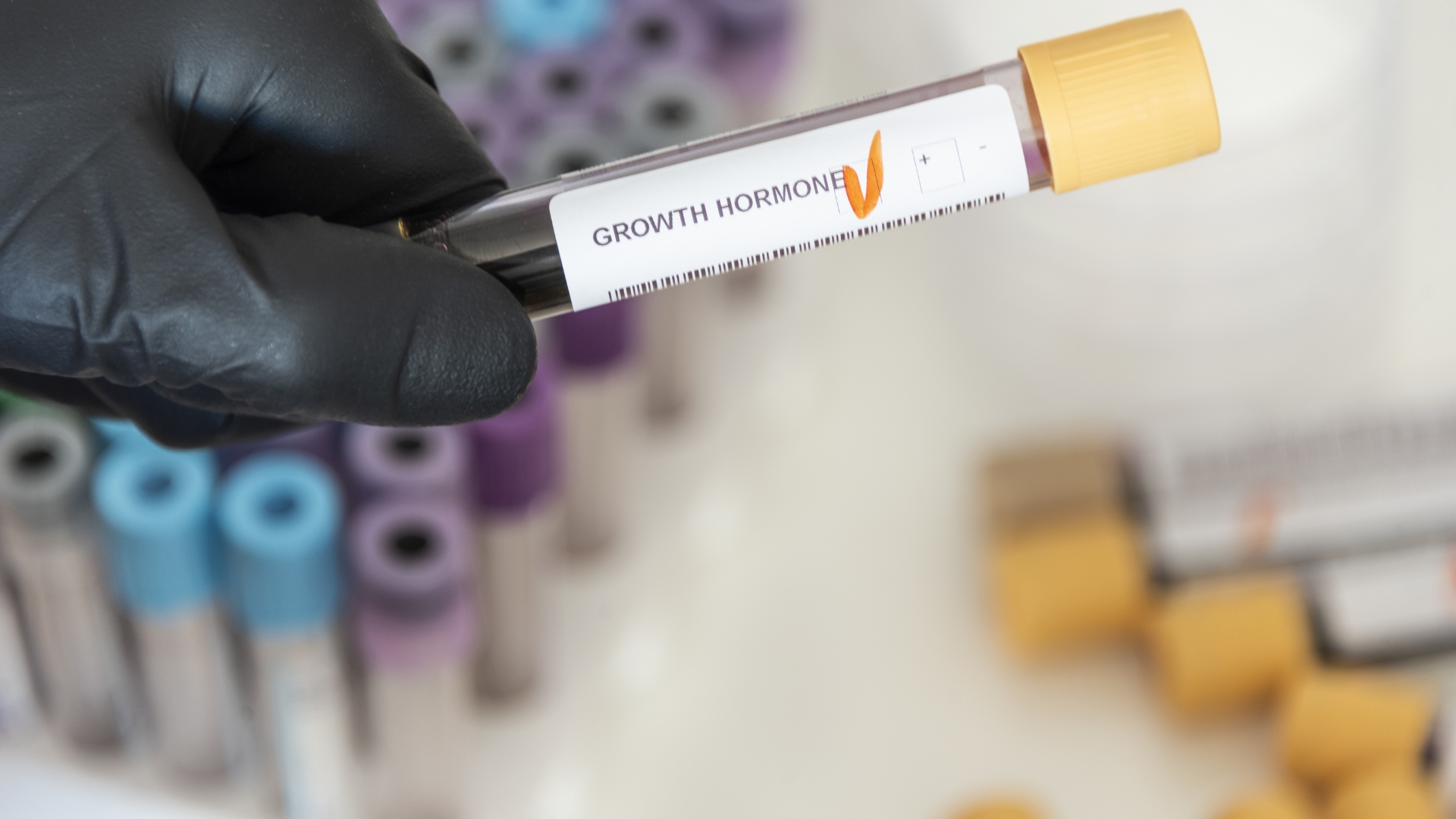 Xét nghiệm định lượng nồng độ hGH dùng để phát hiện các rối loạn liên quan đến hormone tăng trưởng