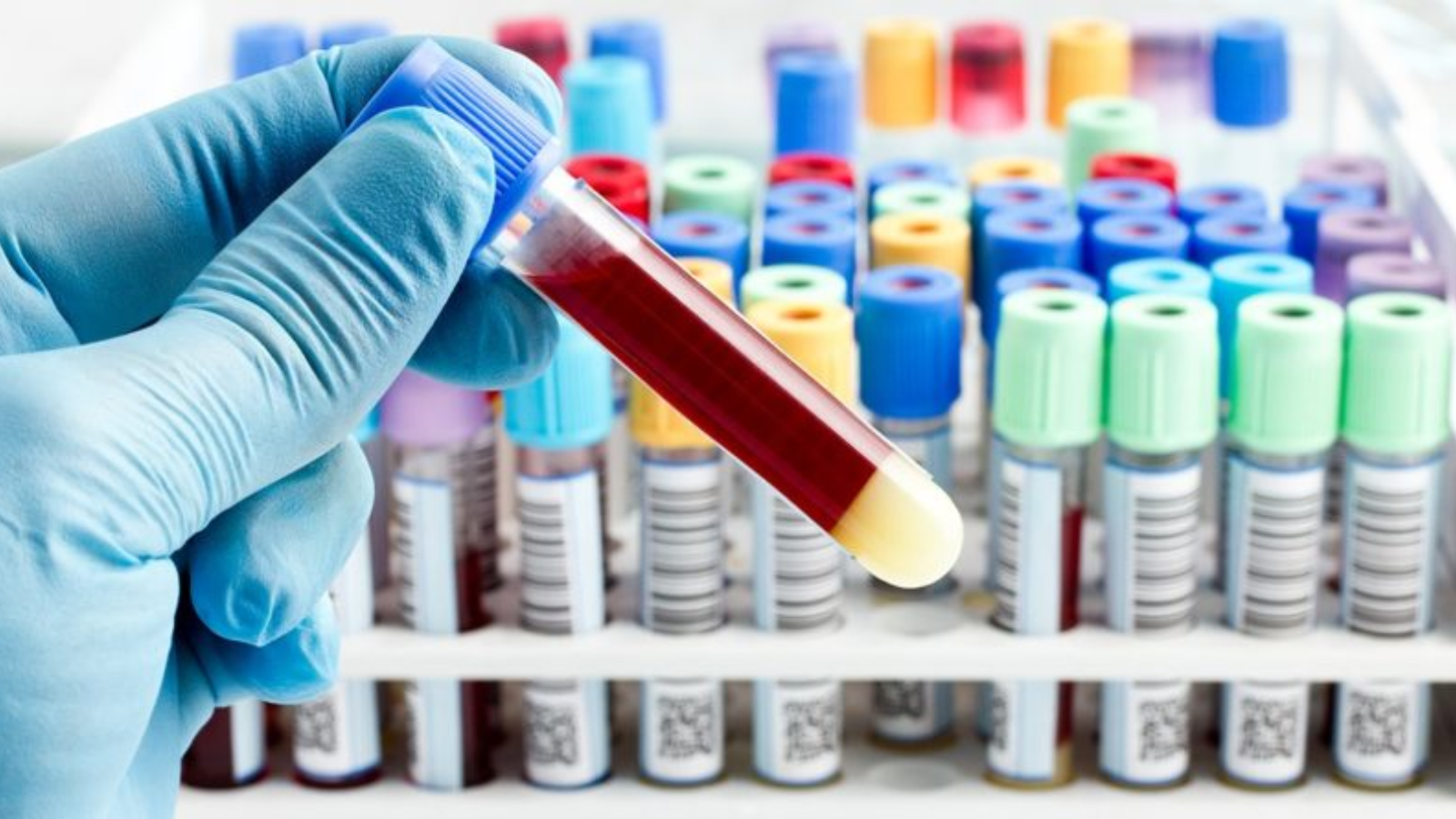 Xét nghiệm đột biến gen ung thư phổi giúp cá thể hóa, dự đoán đáp ứng điều trị và theo dõi diễn tiến bệnh