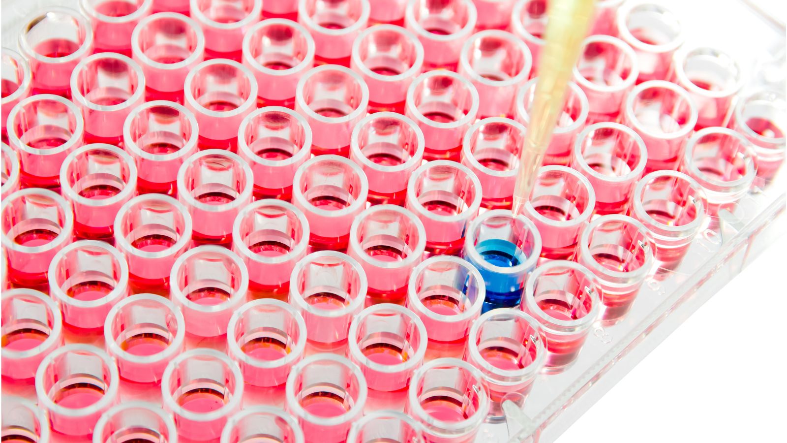 xet-nghiem-elisa-nham-lam-gi-va-quy-trinh-ra-sao-2