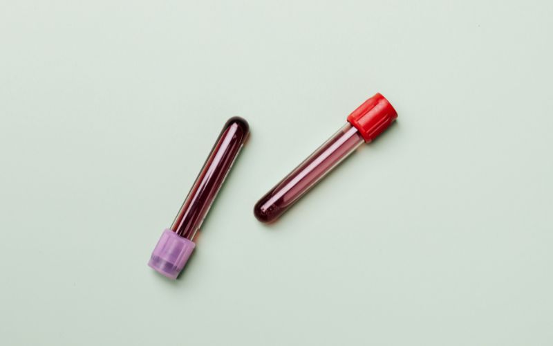 Xét nghiệm ferritin là xét nghiệm đánh giá tình trạng dự trữ sắt trong cơ thể