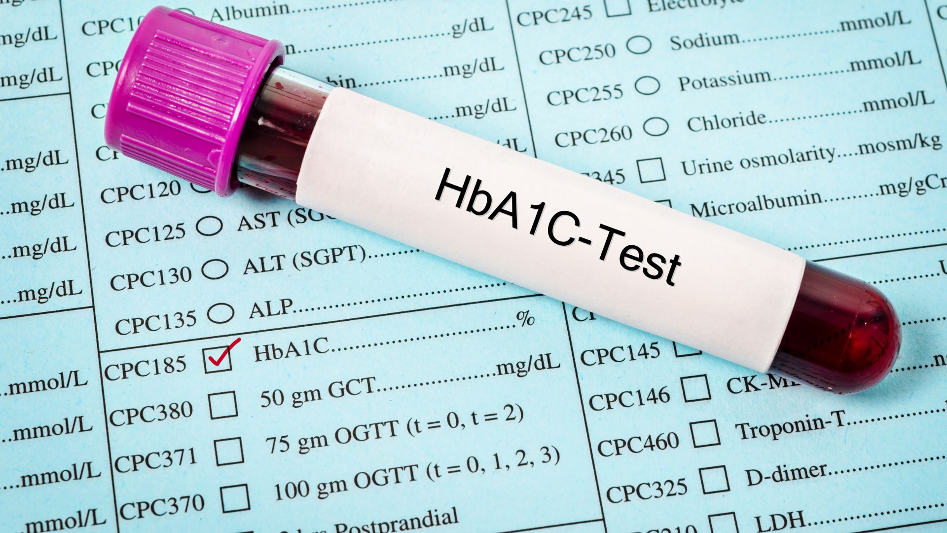 Bệnh nhân có kết quả xét nghiệm HbA1c sai lệch thường được thay thế bằng Fructosamine