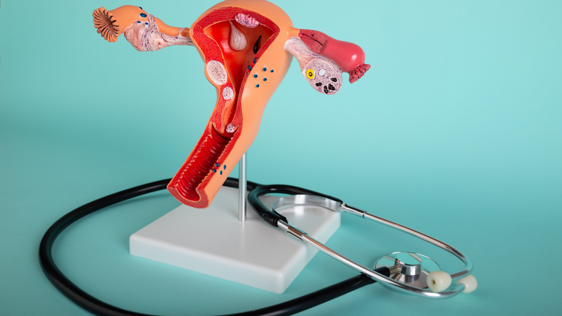 FSH là chỉ số quan trọng trong đánh giá dự trữ buồng trứng và khả năng sinh sản