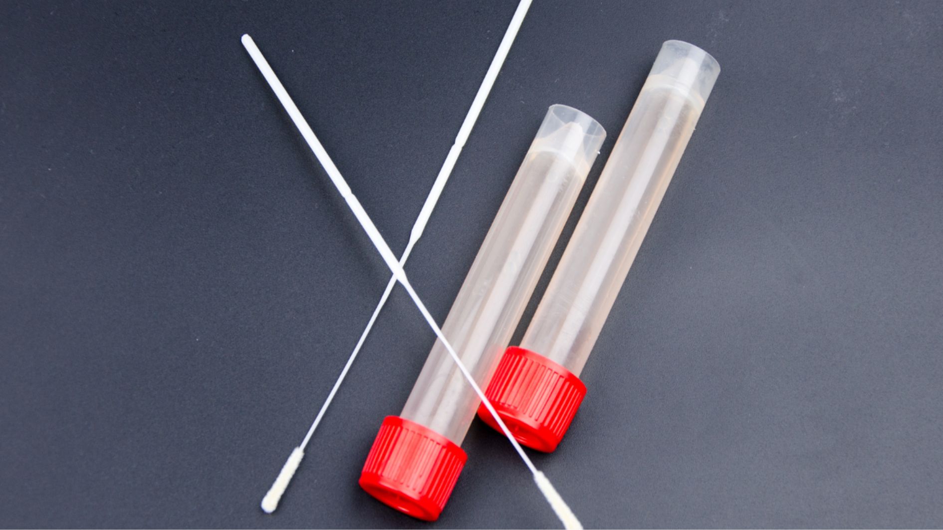 Xét nghiệm GBS giá bao nhiêu? Chi phí phụ thuộc nhiều yếu tố