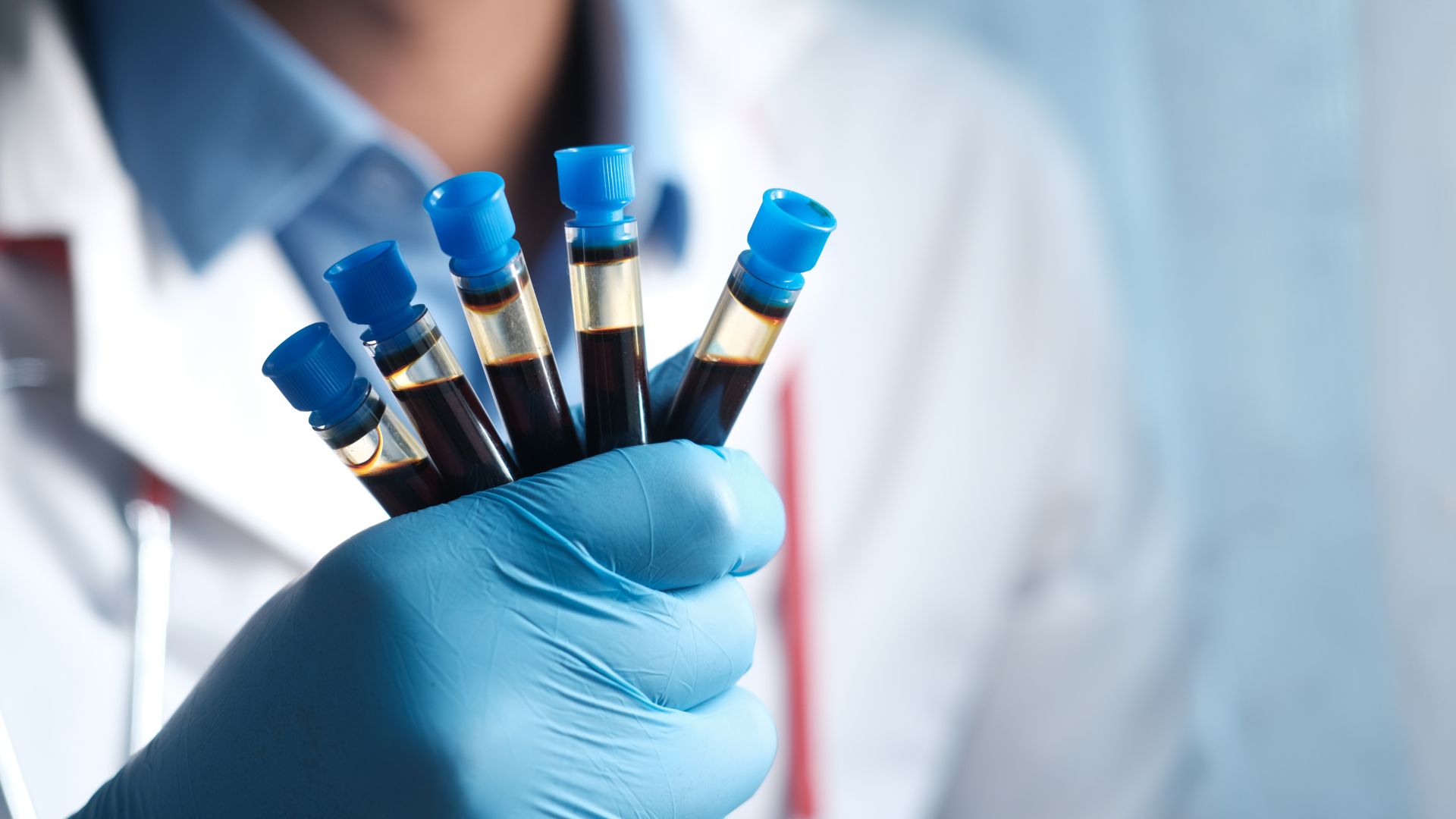 Kết quả xét nghiệm gen Hemophilia giúp phát hiện người mang gen bệnh và hỗ trợ tư vấn di truyền cho gia đình.