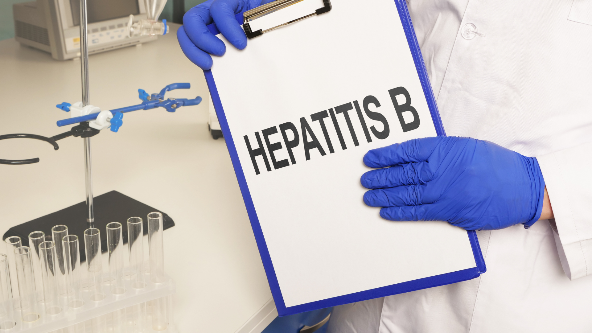 Xét nghiệm HBsAb giúp bác sĩ xác định khả năng miễn dịch với virus viêm gan B