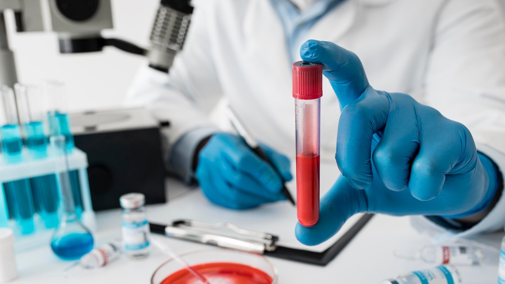 Xét nghiệm HBeAg là xét nghiệm máu quan trọng dùng để kiểm tra sự hiện diện của kháng nguyên e (HBeAg)