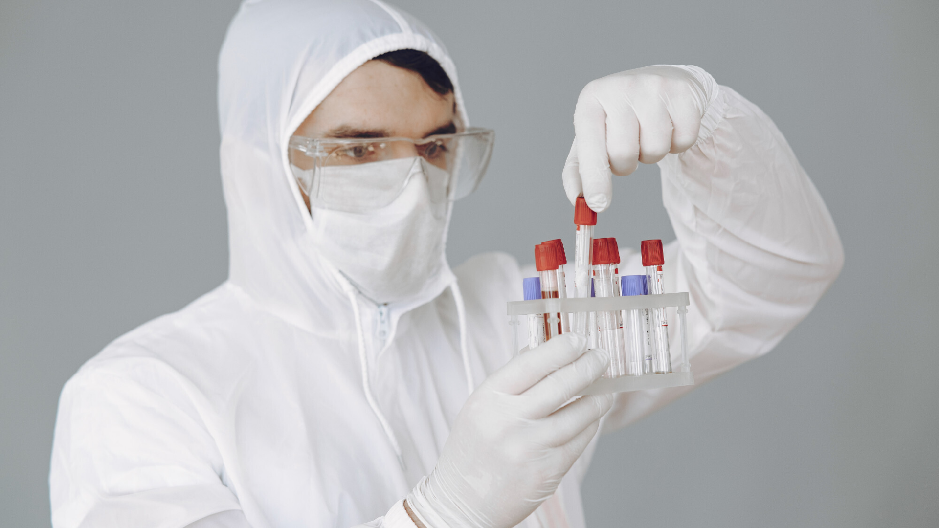 Xét nghiệm HIV có bị sai kết quả không? Xử lý thế nào khi kết quả xét nghiệm HIV không như mong đợi?