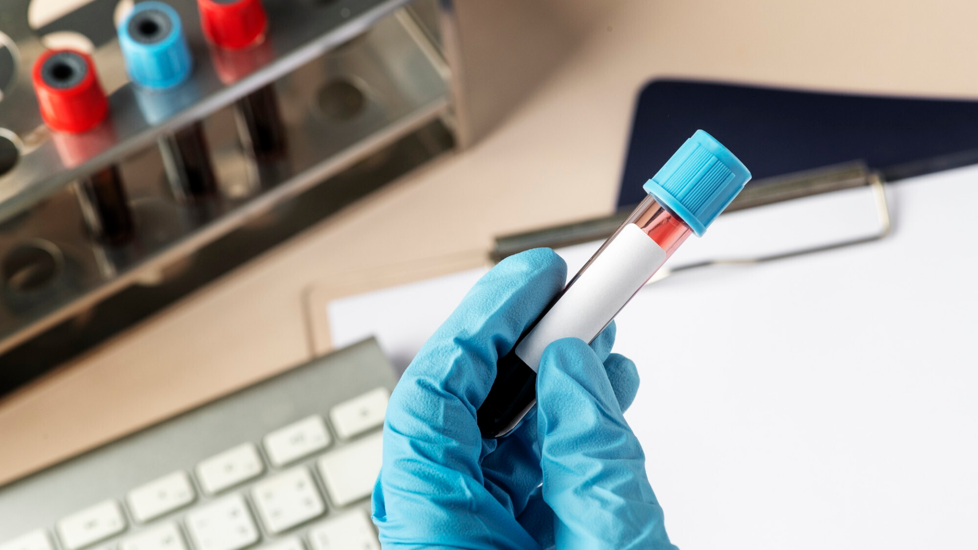 xet-nghiem-hiv-combi-pt-khi-nao-nen-lam-va-cach-hieu-ket-qua-xet-nghiem 3.png