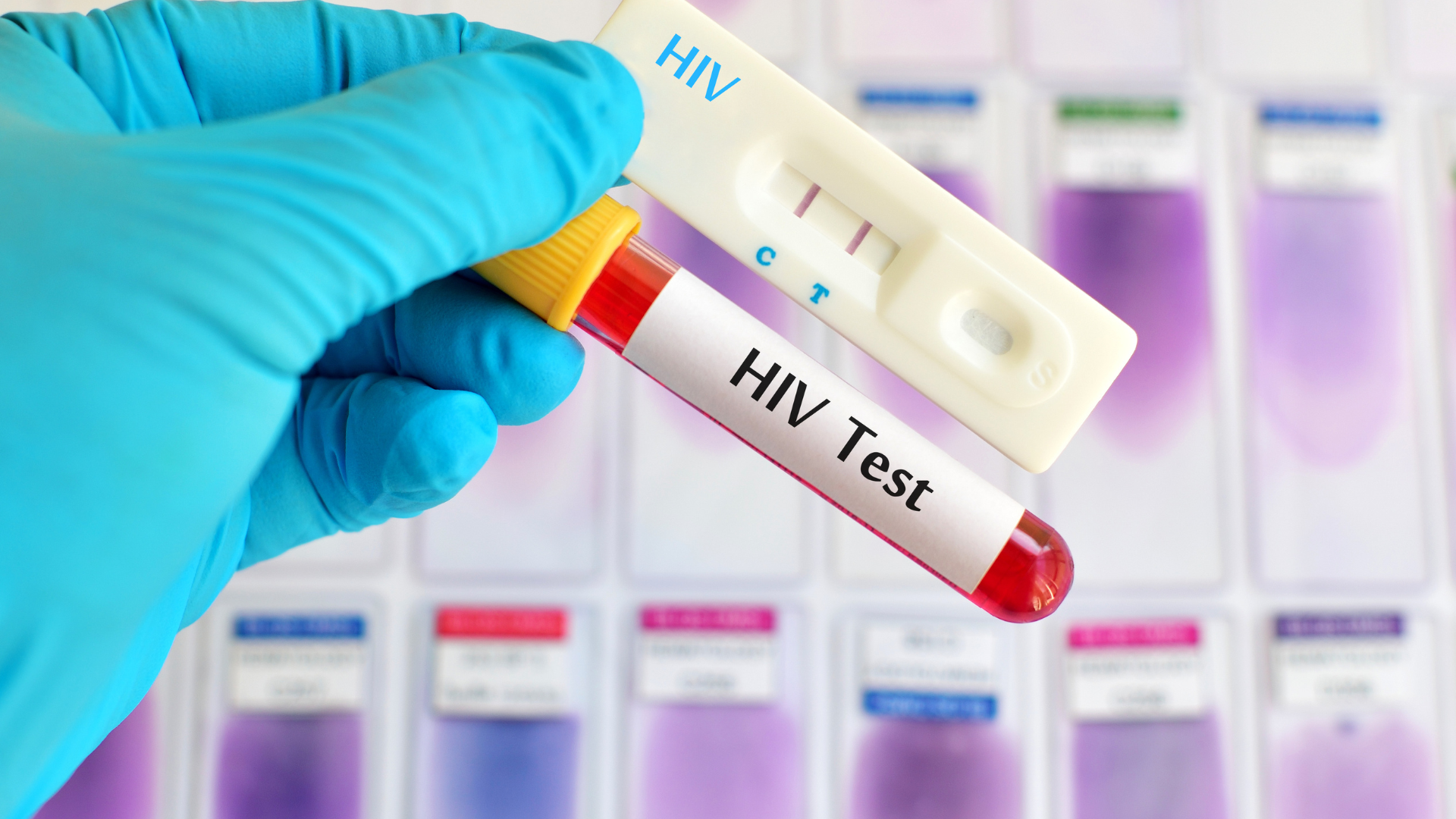 Nên xét nghiệm HIV sau 4 tuần kể từ khi có hành vi nguy cơ