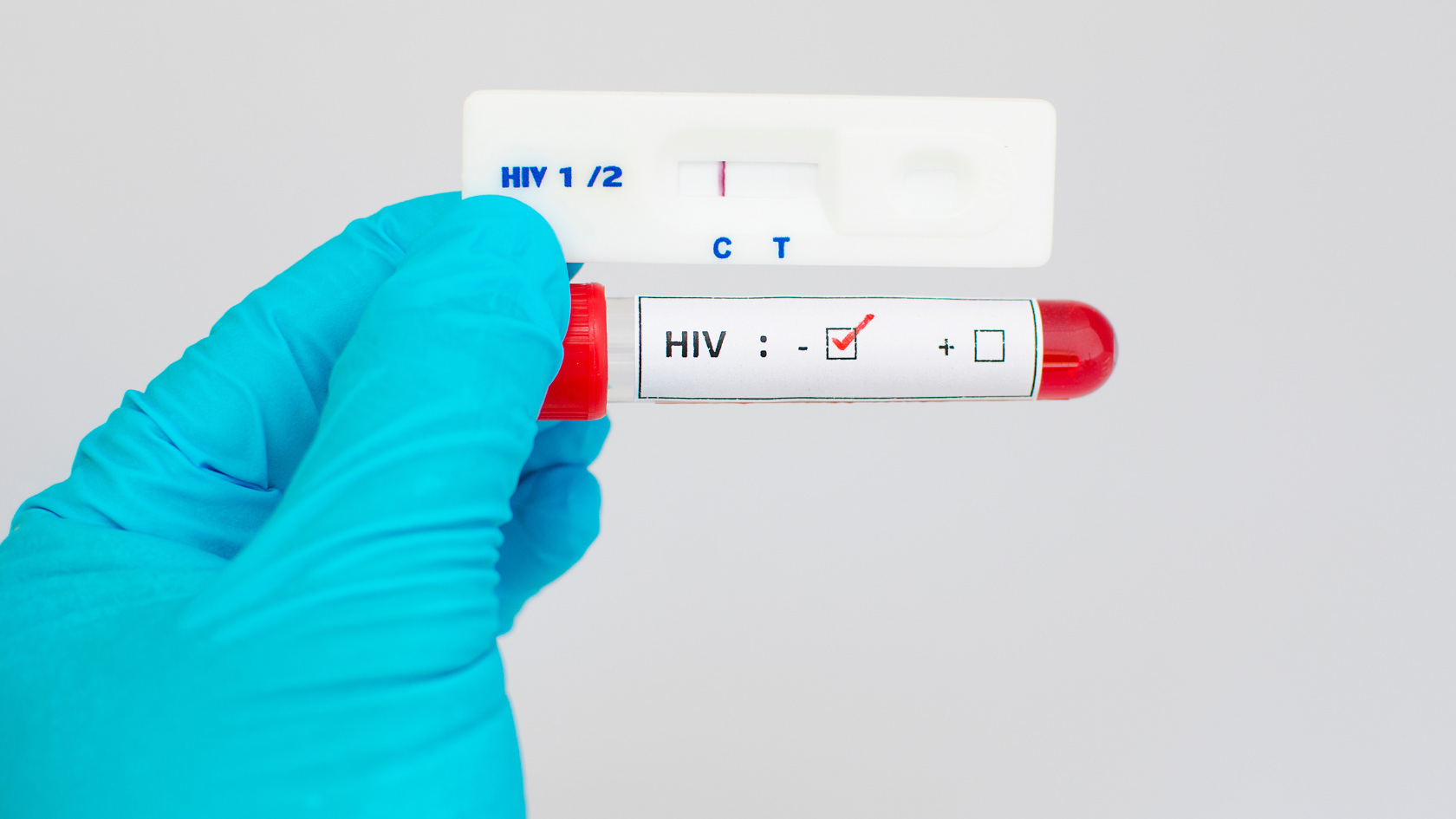 Xét nghiệm HIV sau 1 tháng có chính xác không phụ thuộc rất lớn vào loại xét nghiệm sử dụng
