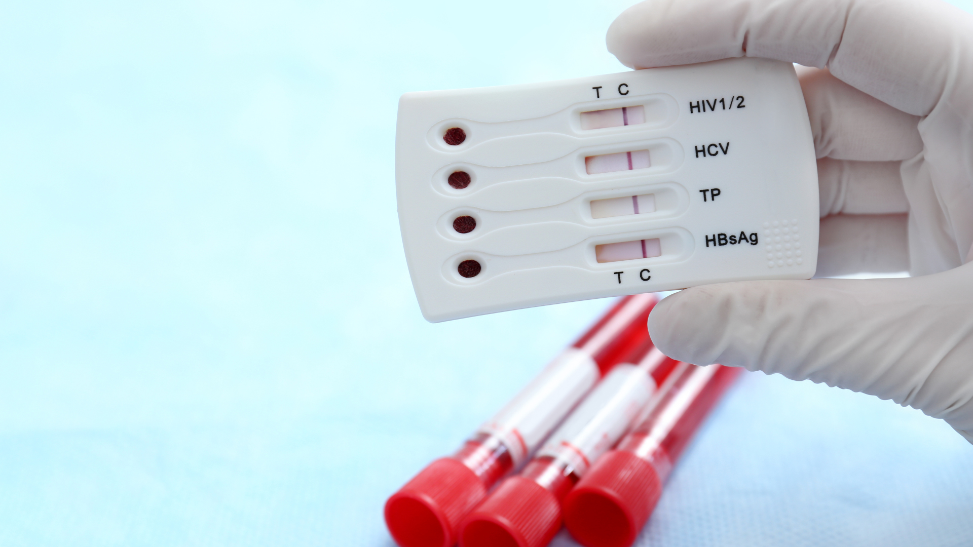 Việc tự thực hiện xét nghiệm tại nhà có thể giúp tiết kiệm thời gian, chi phí và đảm bảo quyền riêng tư