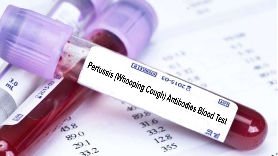 Xét nghiệm ho gà dao động từ 300.000 - 1.200.000 đồng