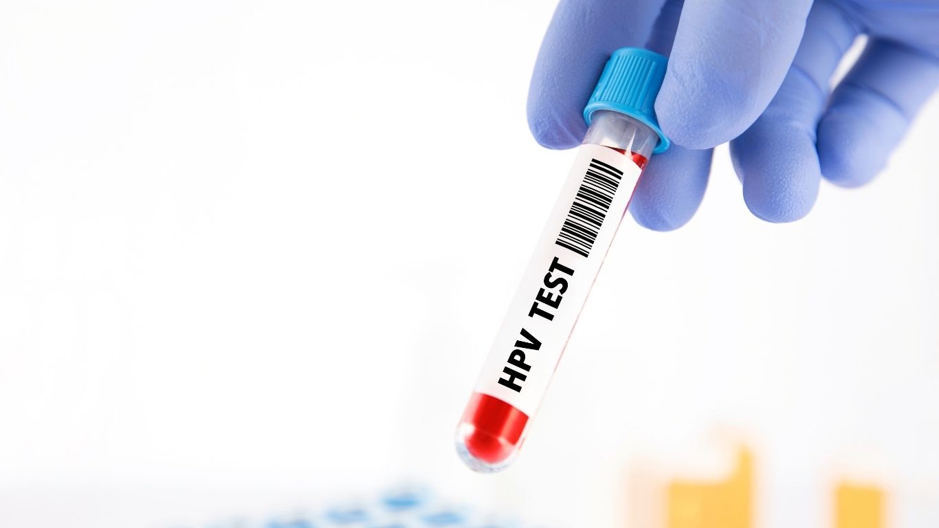 Xét nghiệm HPV bao lâu 1 lần? Cập nhật mới nhất dành cho nữ giới 3