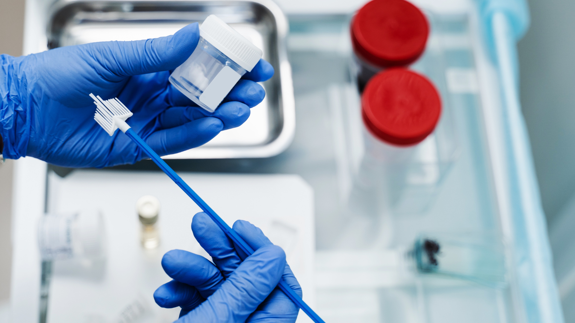 xet-nghiem-hpv-bao-lau-co-ket-qua-va-nhung-dieu-can-luu-y-khi-xet-nghiem-hpv 1.png