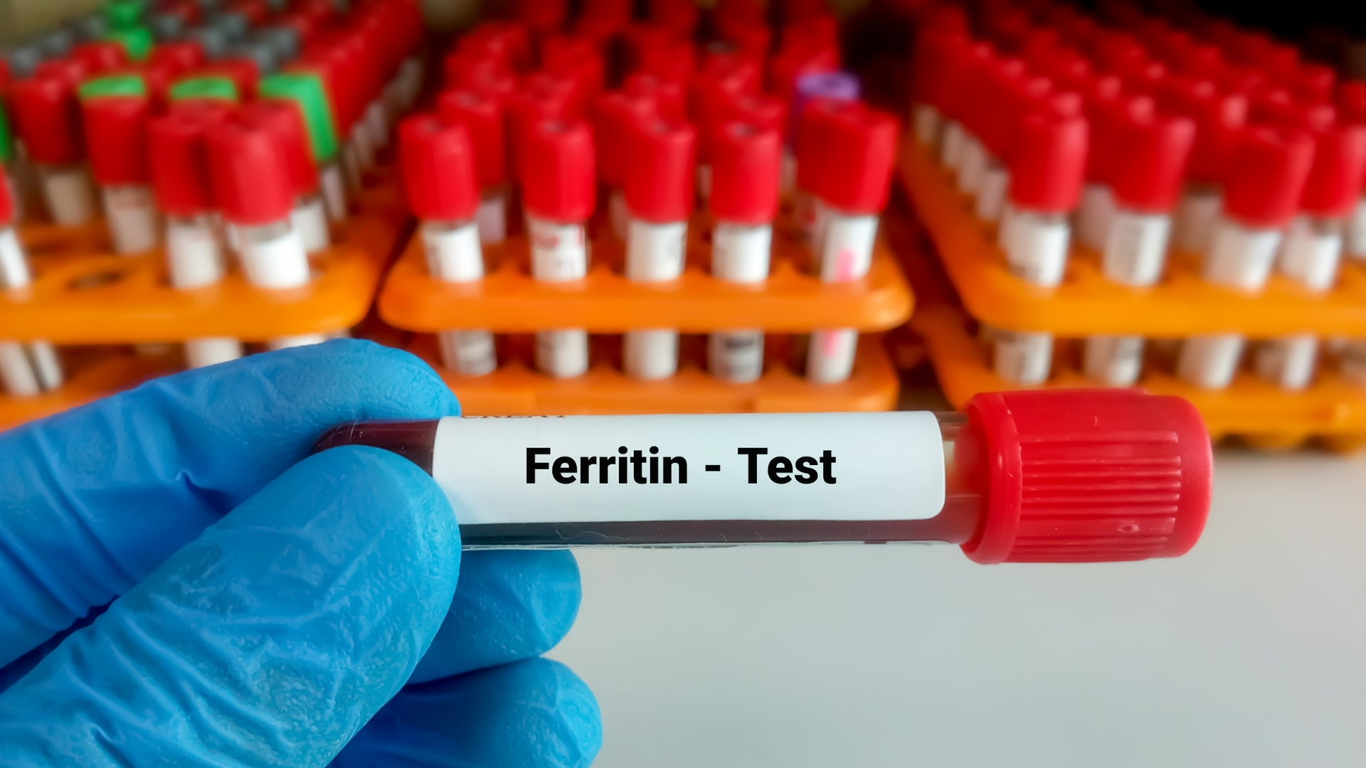 Xét nghiệm ferritin có thể được chỉ định tùy theo trường hợp