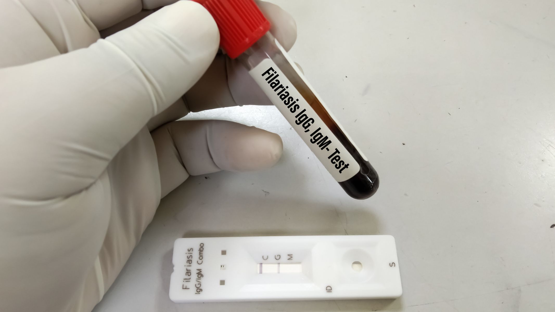 Xét nghiệm IgG là gì?