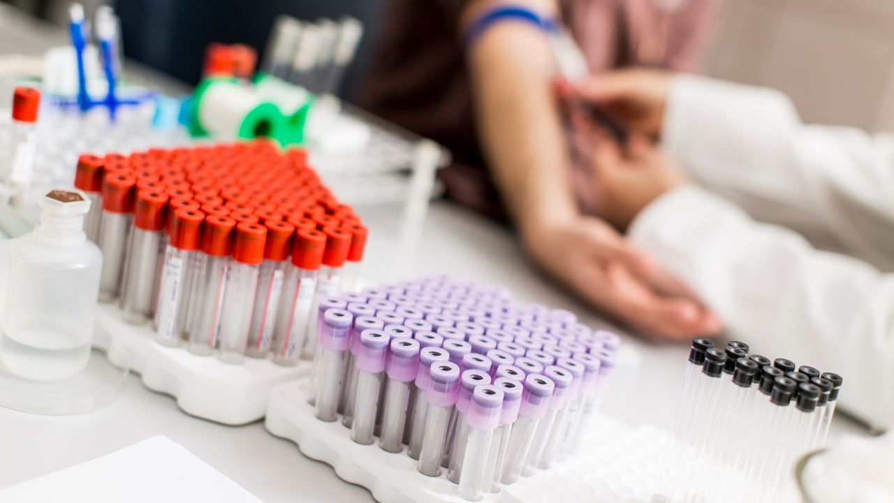 Kết quả xét nghiệm INR giúp bác sĩ đánh giá mức độ đông máu của cơ thể