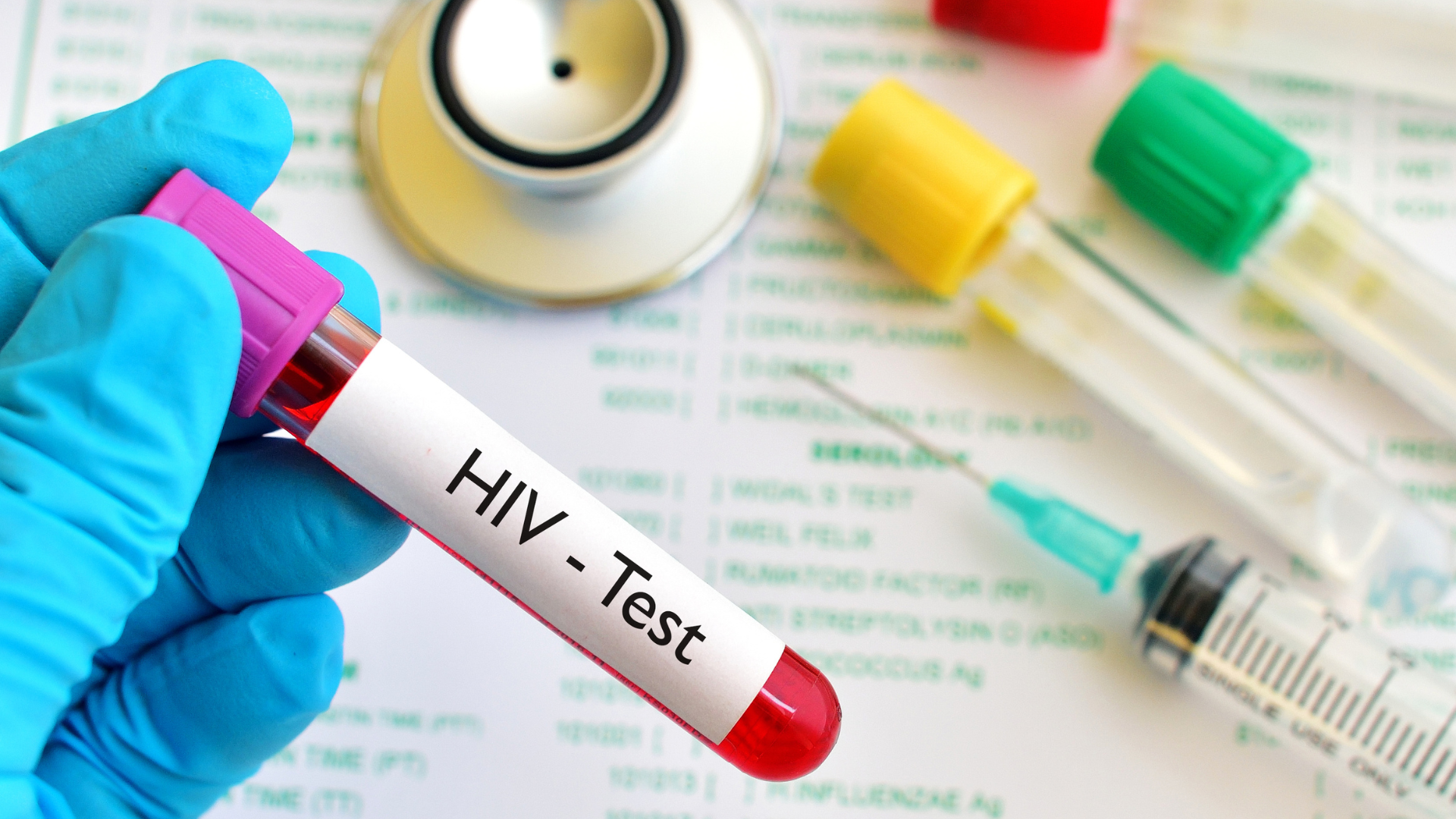 Xét nghiệm khẳng định HIV là bước quan trọng không thể bỏ qua