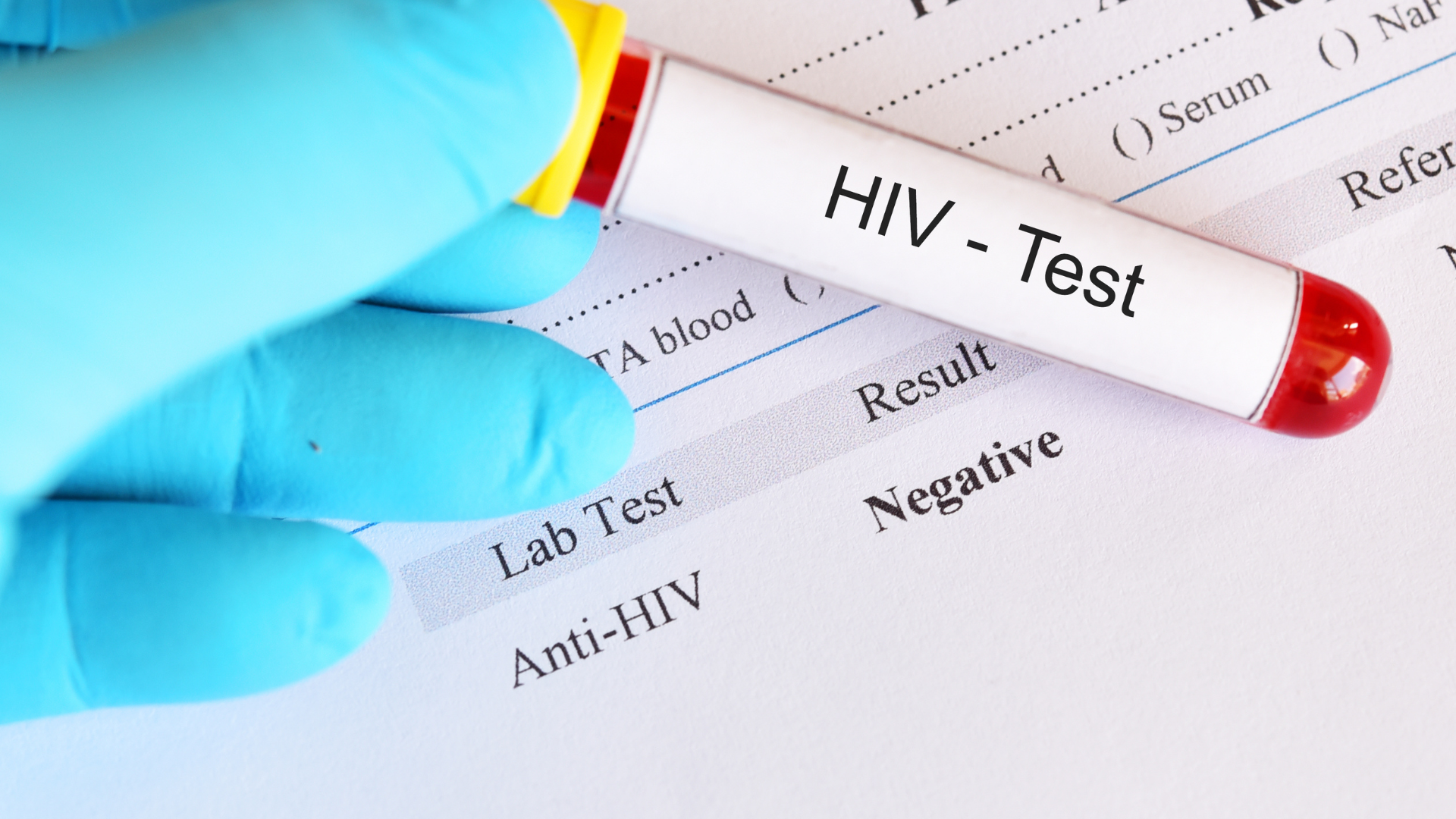 Thời gian trả kết quả xét nghiệm khẳng định thường từ 1 đến 3 ngày