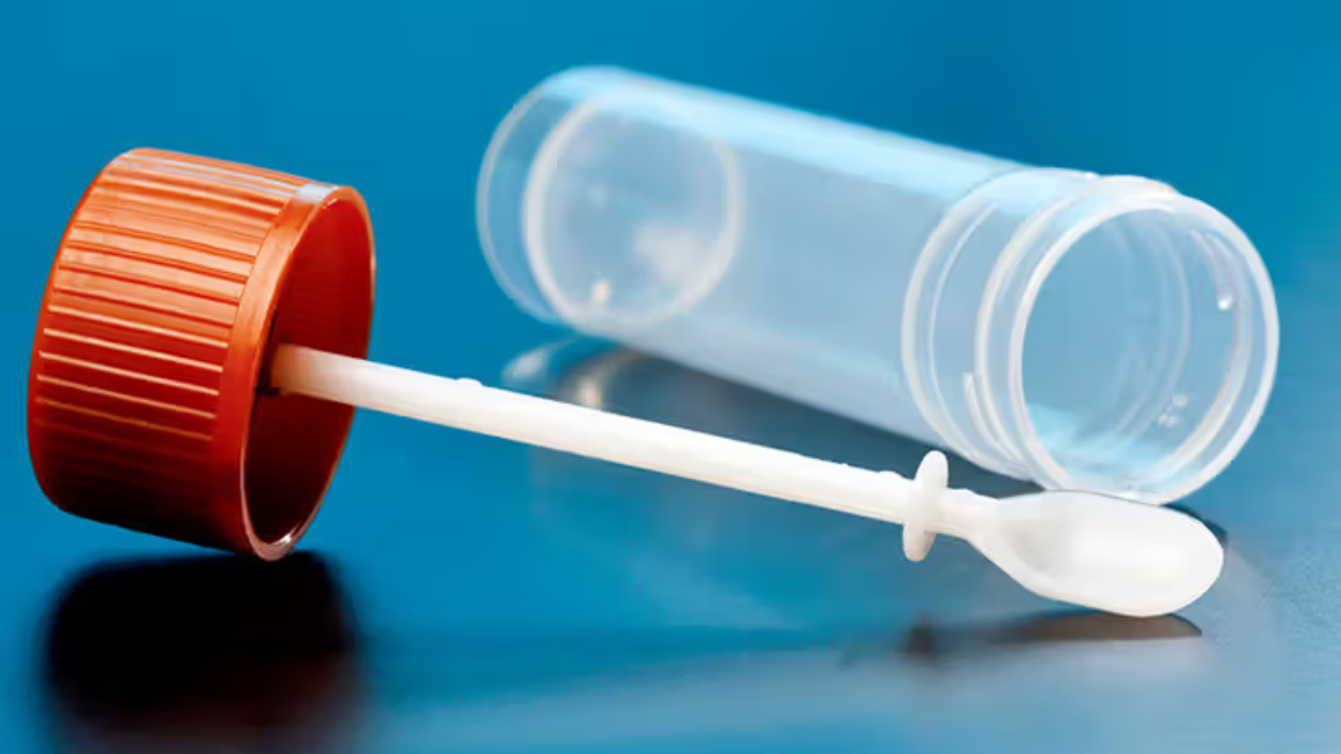 Xét nghiệm ký sinh trùng bao lâu có kết quả? Xét nghiệm soi phân thường có trong ngày hoặc trong 24 giờ