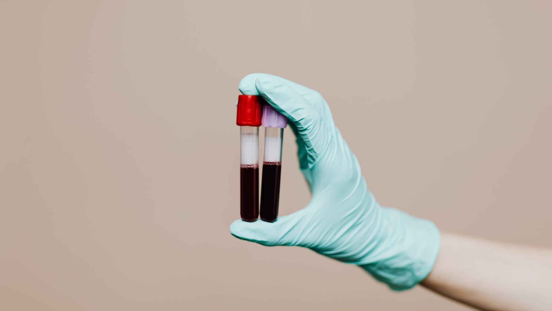 xet-nghiem-mau-de-lam-gi-khi-nao-can-thuc-hien-xet-nghiem-mau 2.png