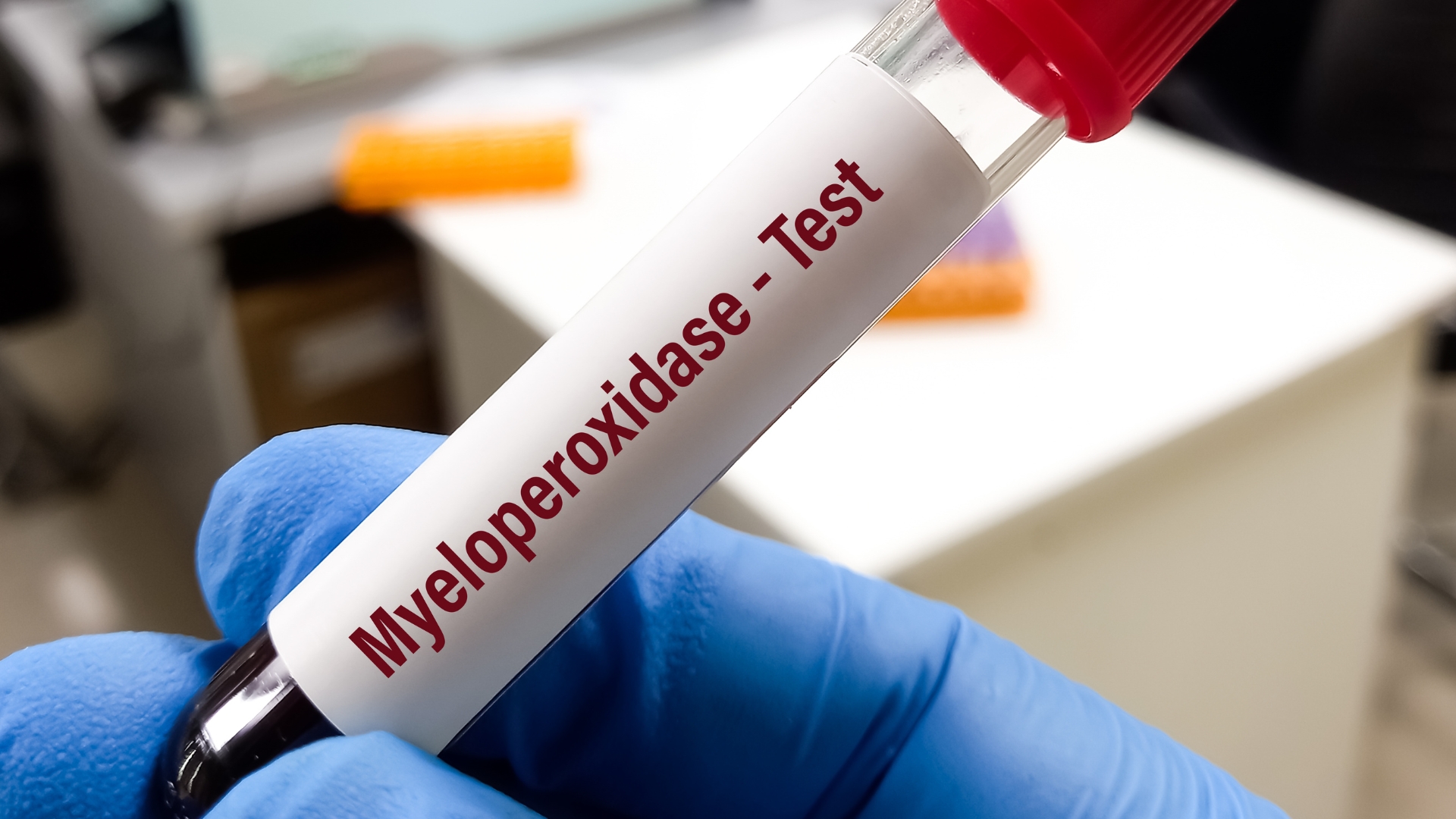 Xét nghiệm MPO là một xét nghiệm huyết thanh học được thực hiện nhằm phát hiện tự kháng thể kháng Myeloperoxidase