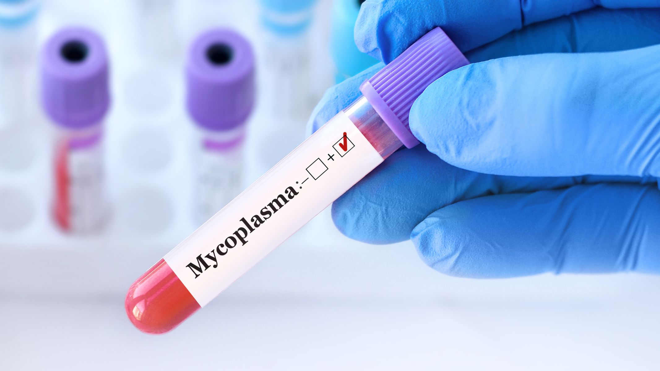 Kết quả dương tính không đồng nghĩa với bệnh lý nghiêm trọng