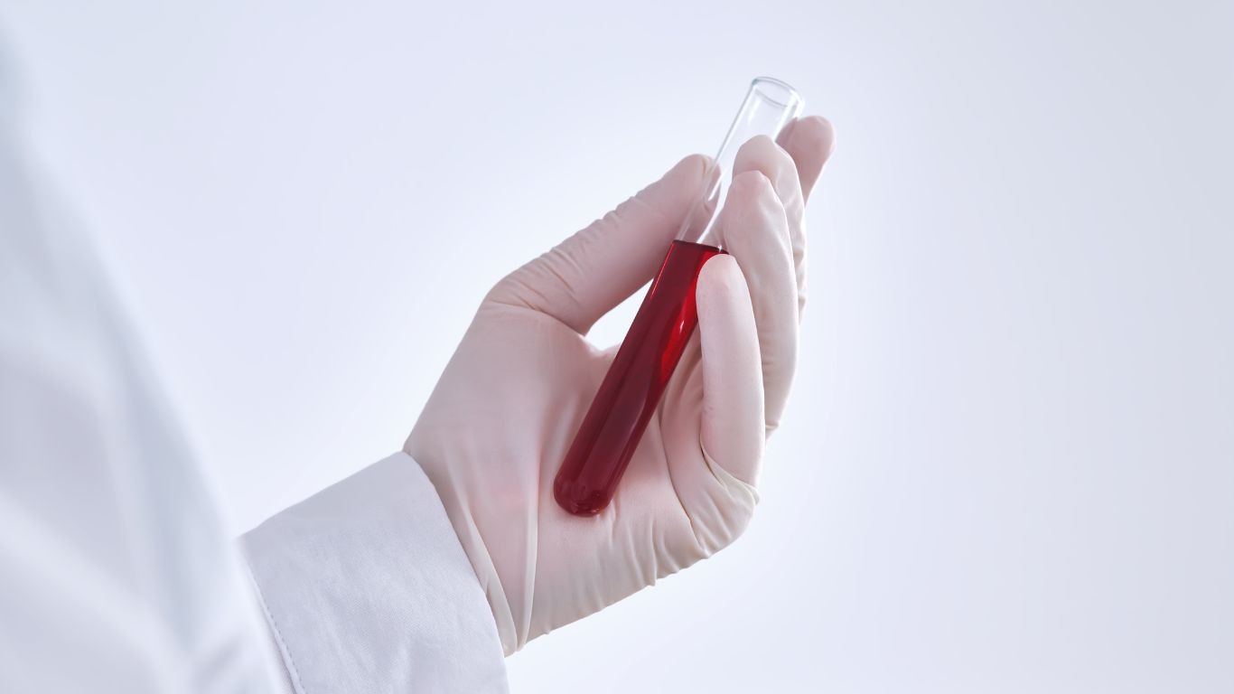 Những lưu ý khi xét nghiệm máu giúp người thực hiện chuẩn bị đúng cách, đảm bảo kết quả chính xác